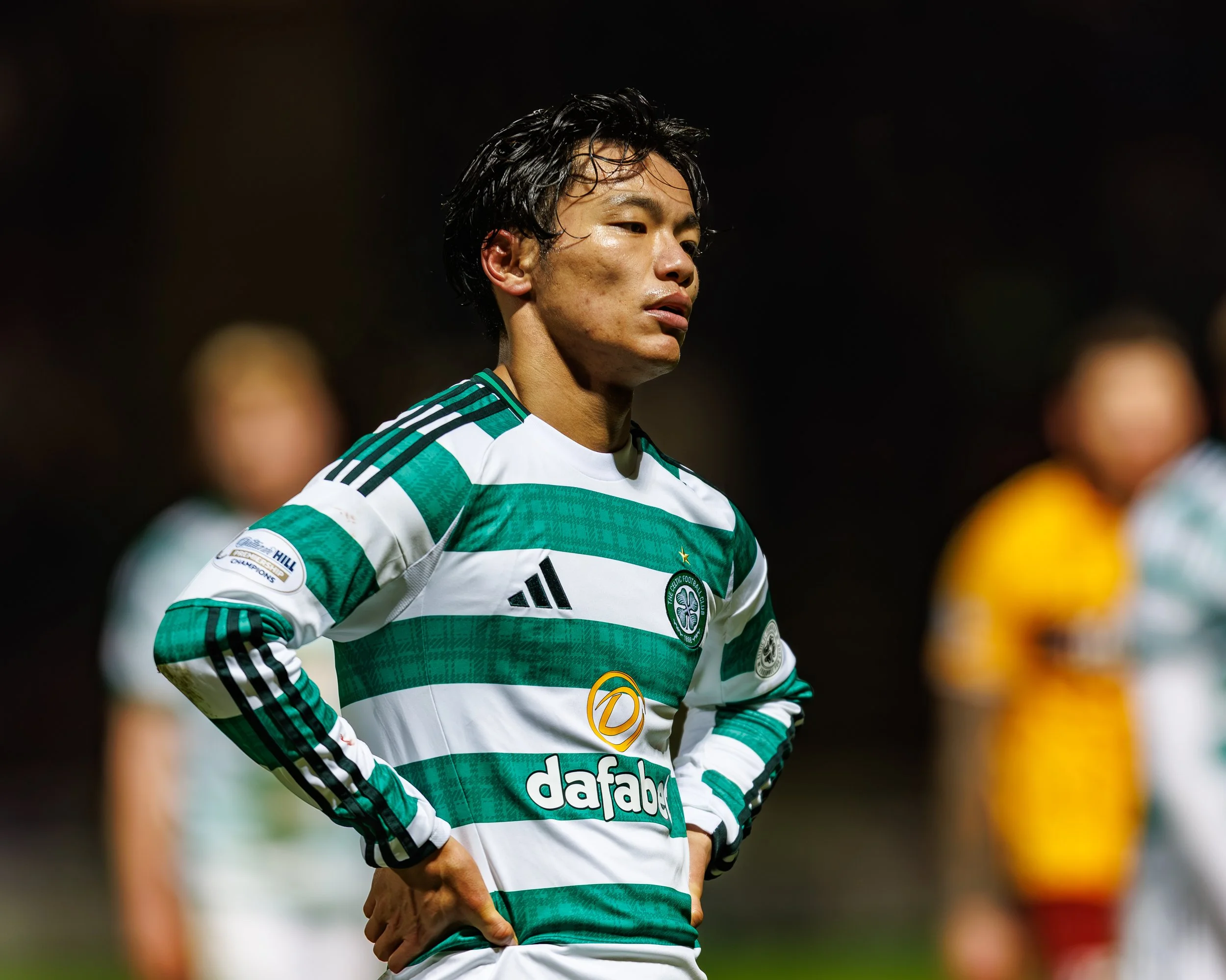 A soccer player in a green and white striped jersey with various logos stands with hands on hips, looking serious during a game, while blurred teammates are in the background.