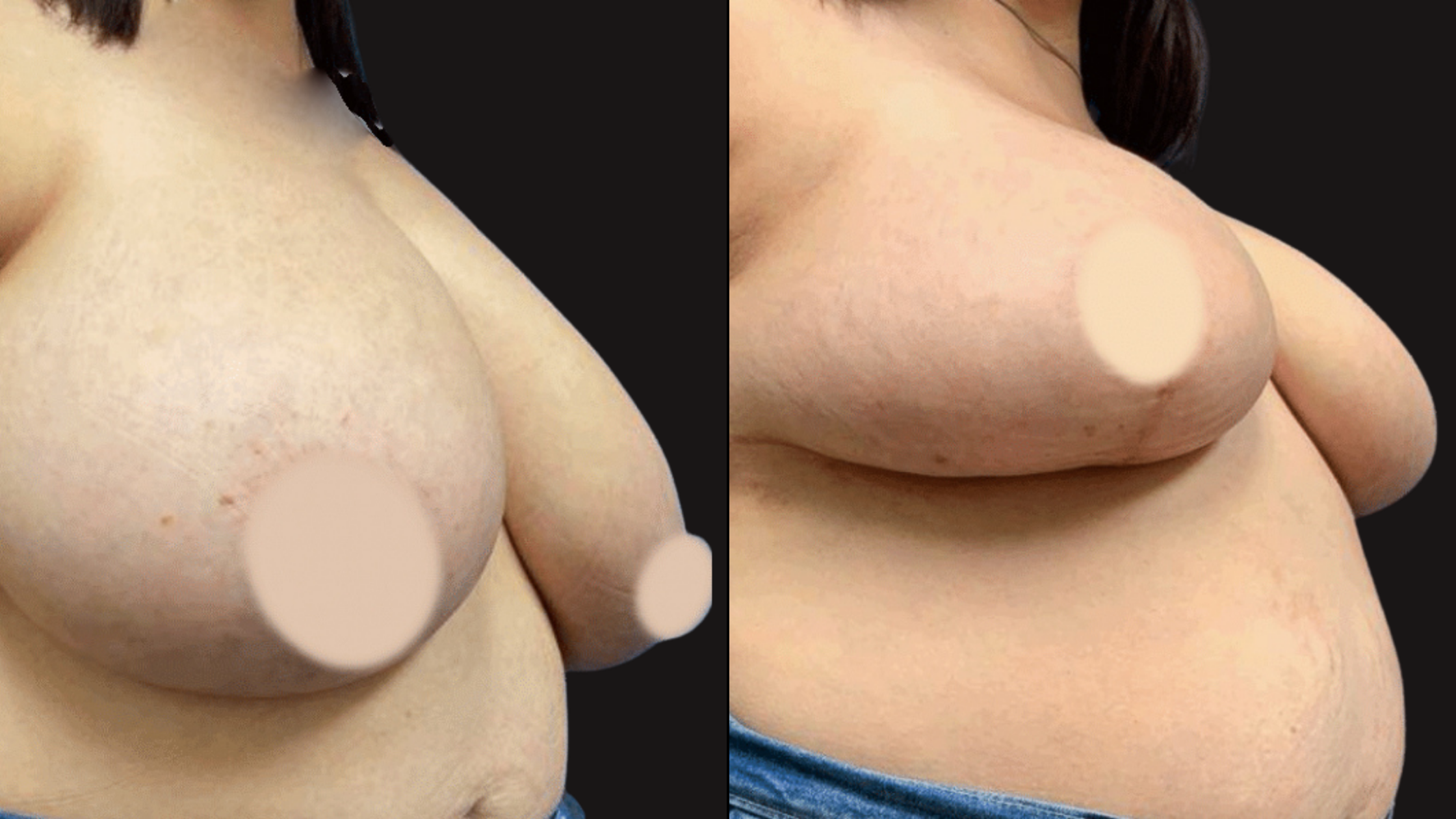 Close-up of a woman's chest and shoulders, with her dark hair visible, against a black background.