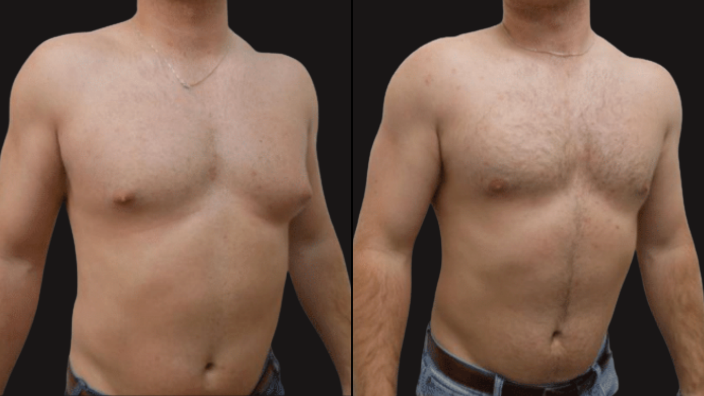 Side-by-side comparison of a man's bare upper body before and after a transformation, showing changes in chest and abdominal area.
