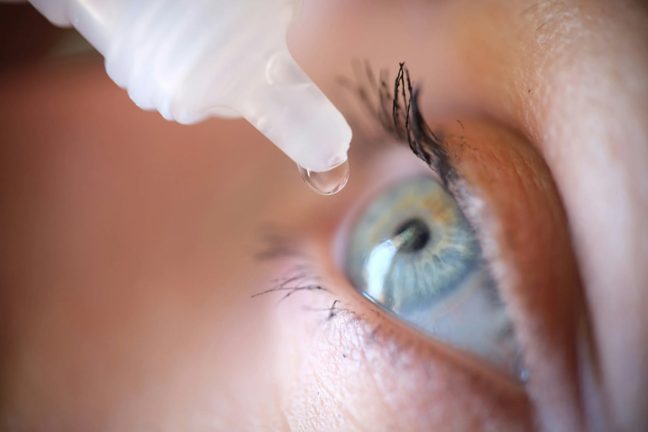 A closeup of eyedrops being administered.