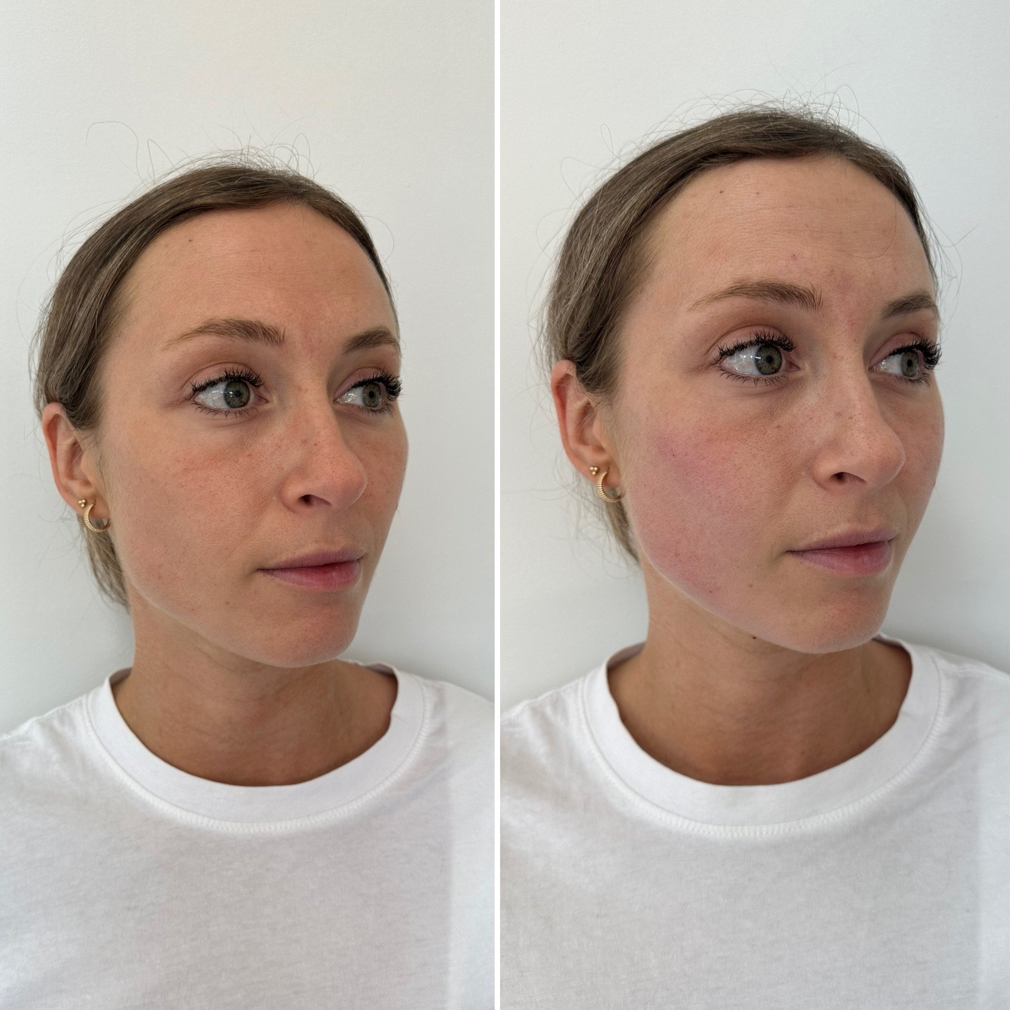 Portrait de deux femmes jeunes avec des piercings d'oreille, sans maquillage visible, portant un t-shirt blanc, sur un fond blanc, vue en gros plan, deux angles différents.