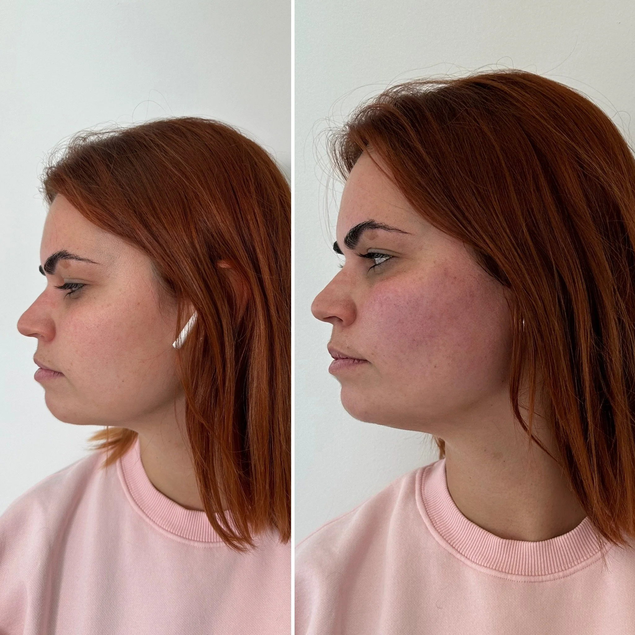 Photo de profil d'une femme aux cheveux roux, montrant deux angles de son visage, portant un sweat rose clair avec un fond blanc.