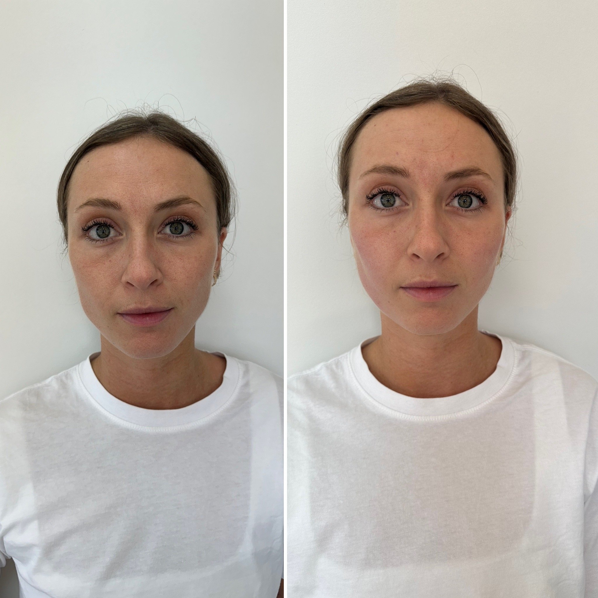 Photo d'une jeune femme avec des cheveux bruns, portant un t-shirt blanc, montrant deux expressions faciales différentes, avec un fond blanc.