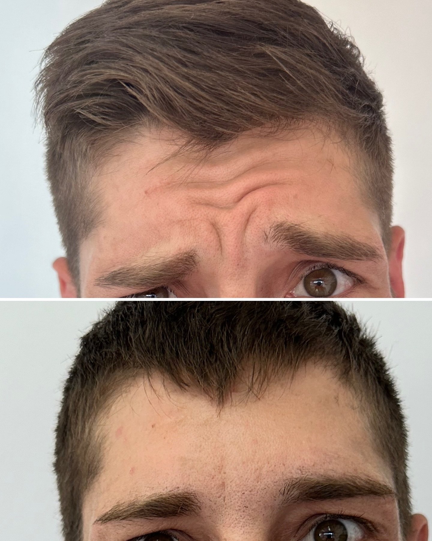 Deux photos rapprochées de la tête d'un homme montrant la transition d'une expression d'inquiétude ou de confusion (haut) à une expression plus neutre ou détendue (bas).