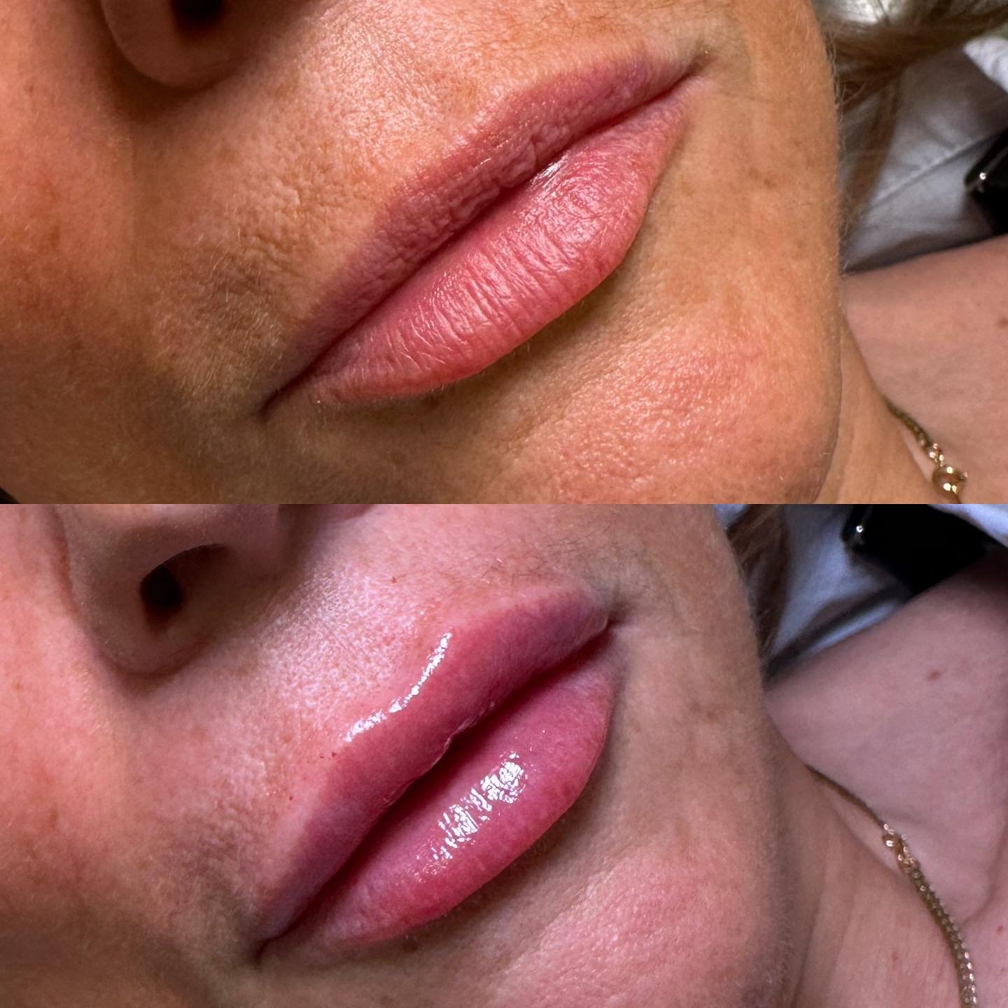 Deux images de lèvres d'une femme, une avant et une après une application de gloss ou de produit cosmétique, avec un focus sur la texture et la brillance des lèvres.