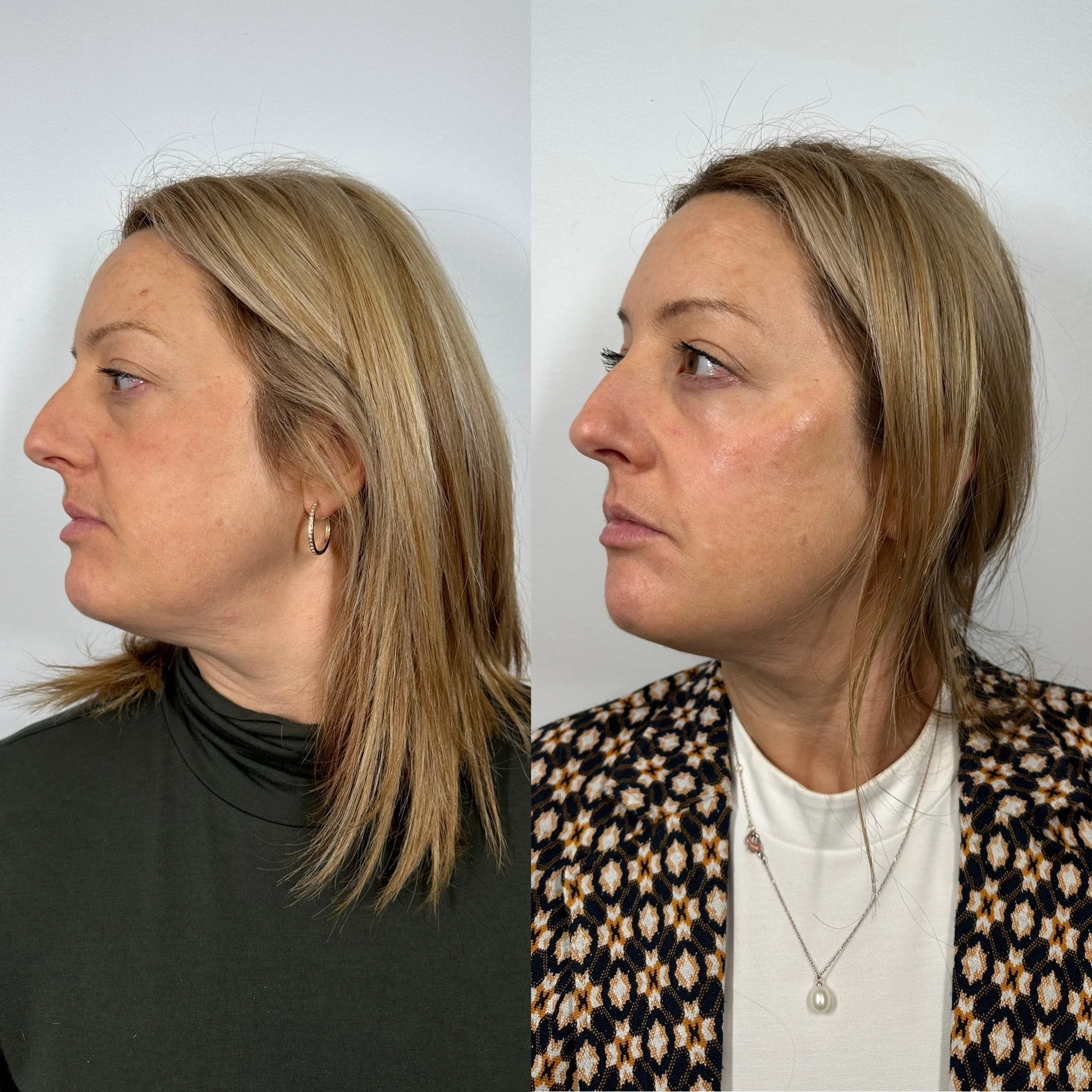 Deux femmes dans des poses de profil, l'une porte un haut noir avec des boucles d'oreilles et l'autre porte une veste à motif léopard avec un pendentif en perle.