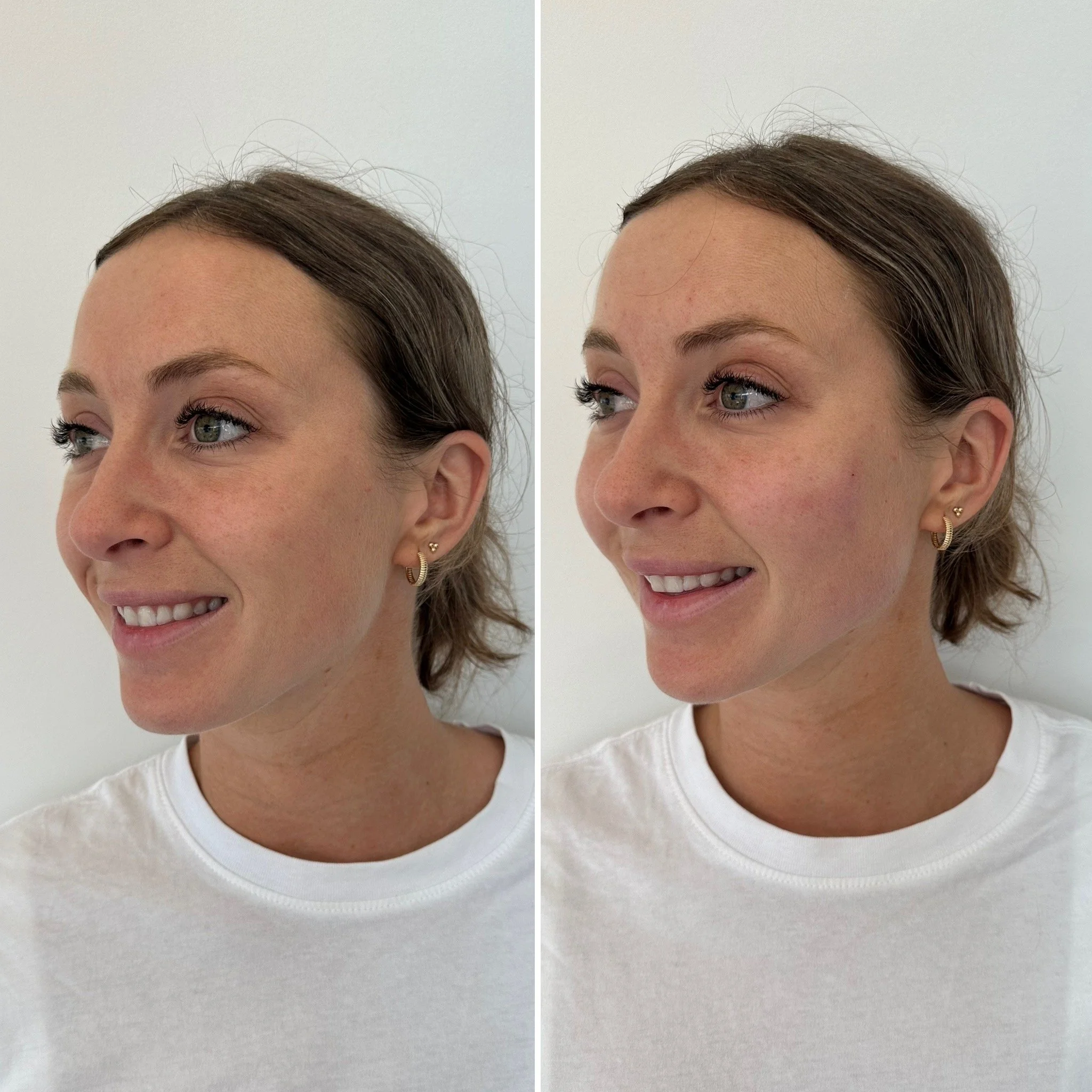 Deux photos d'une femme avec des cheveux bruns, portant un t-shirt blanc, souriant légèrement, prises de côtés différents.