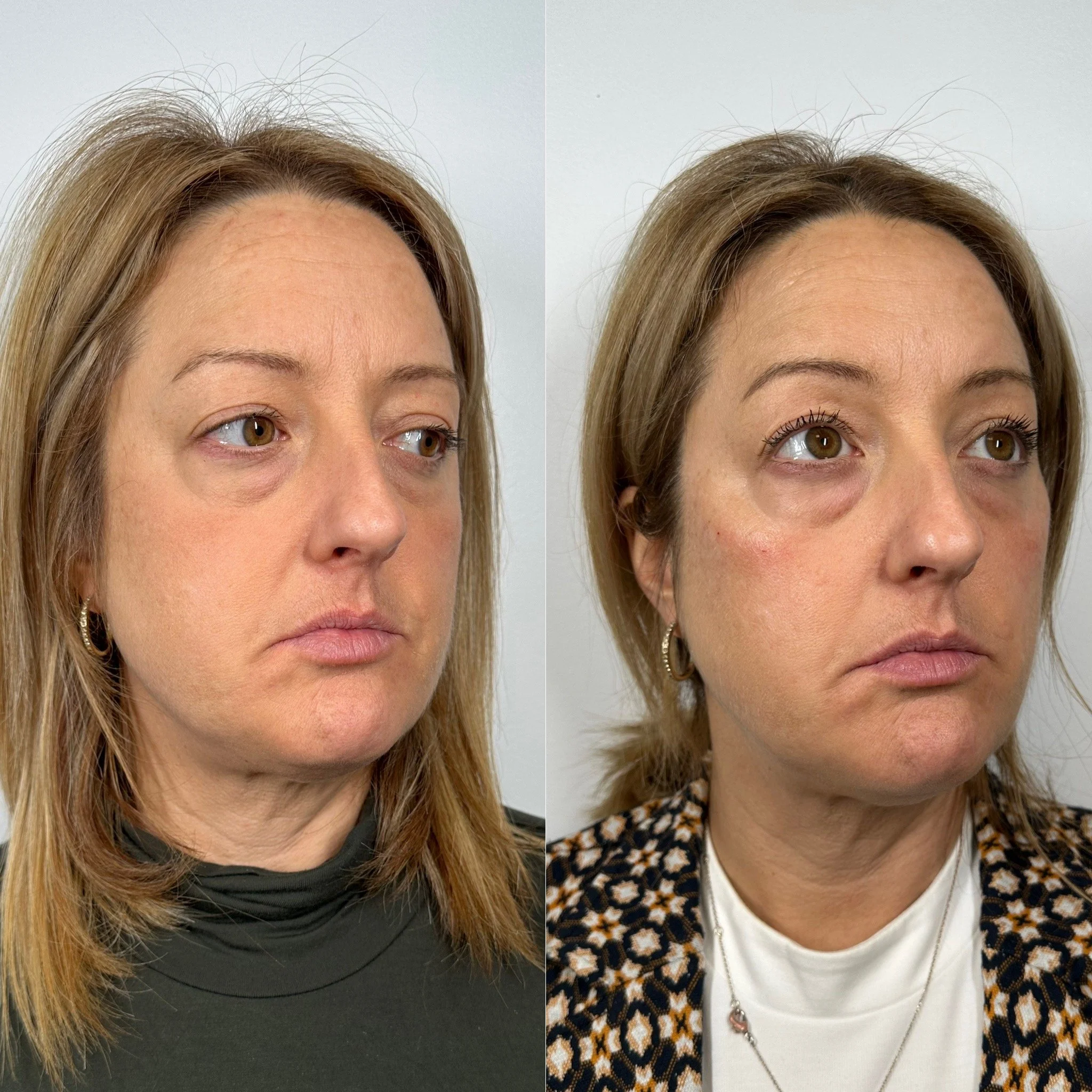 Deux portraits d'une femme, la gauche montrant son visage sans maquillage et la droite avec maquillage, portant une veste à motif animal et un t-shirt blanc.
