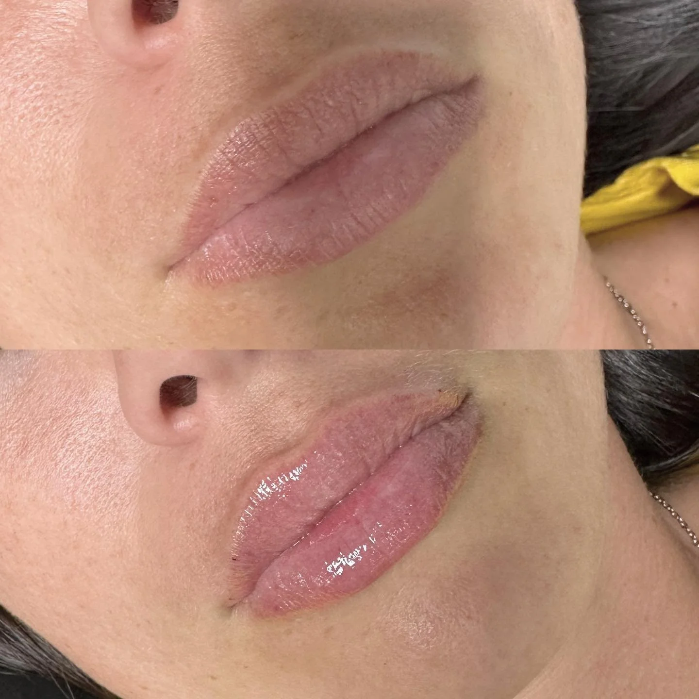 Deux gros plans de lèvres de femme, montrant une différence dans la brillance des lèvres, avec la lèvre inférieure plus brillante dans l'image du bas.