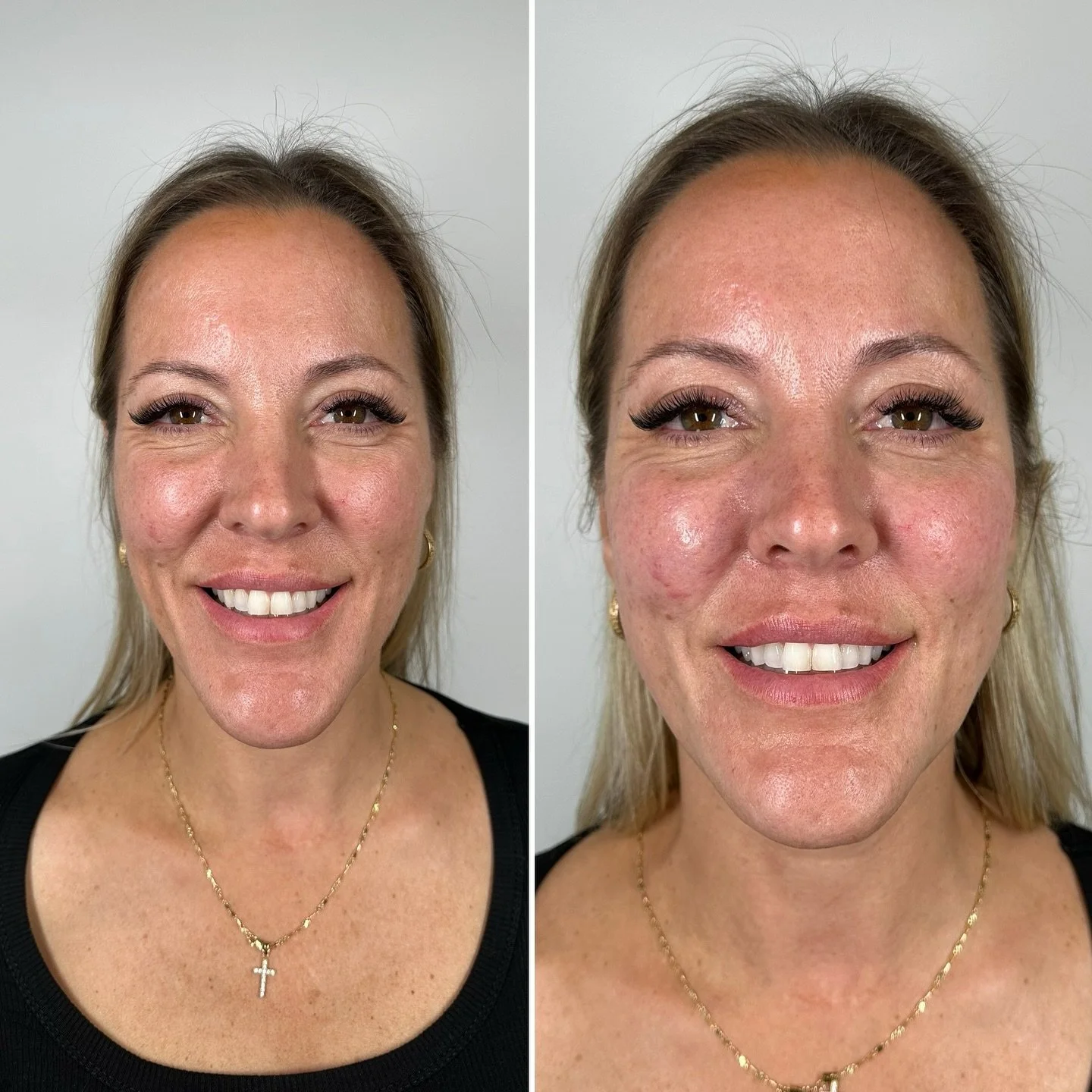 Comparaison avant et après d'une femme, montrant une amélioration de la peau après un traitement ou un maquillage, avec un sourire, portant des boucles d'oreilles et une chaîne avec une croix.