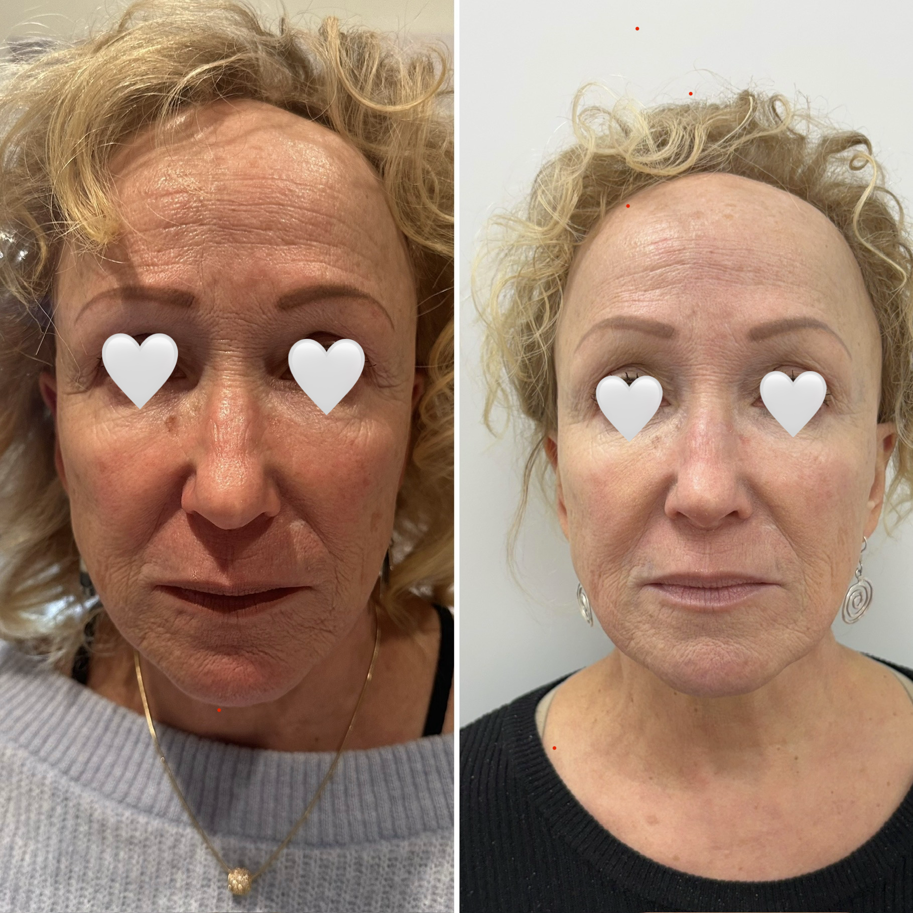 6CD70C7E-C783-4B54-82D5-979D7F85D757 copie.png