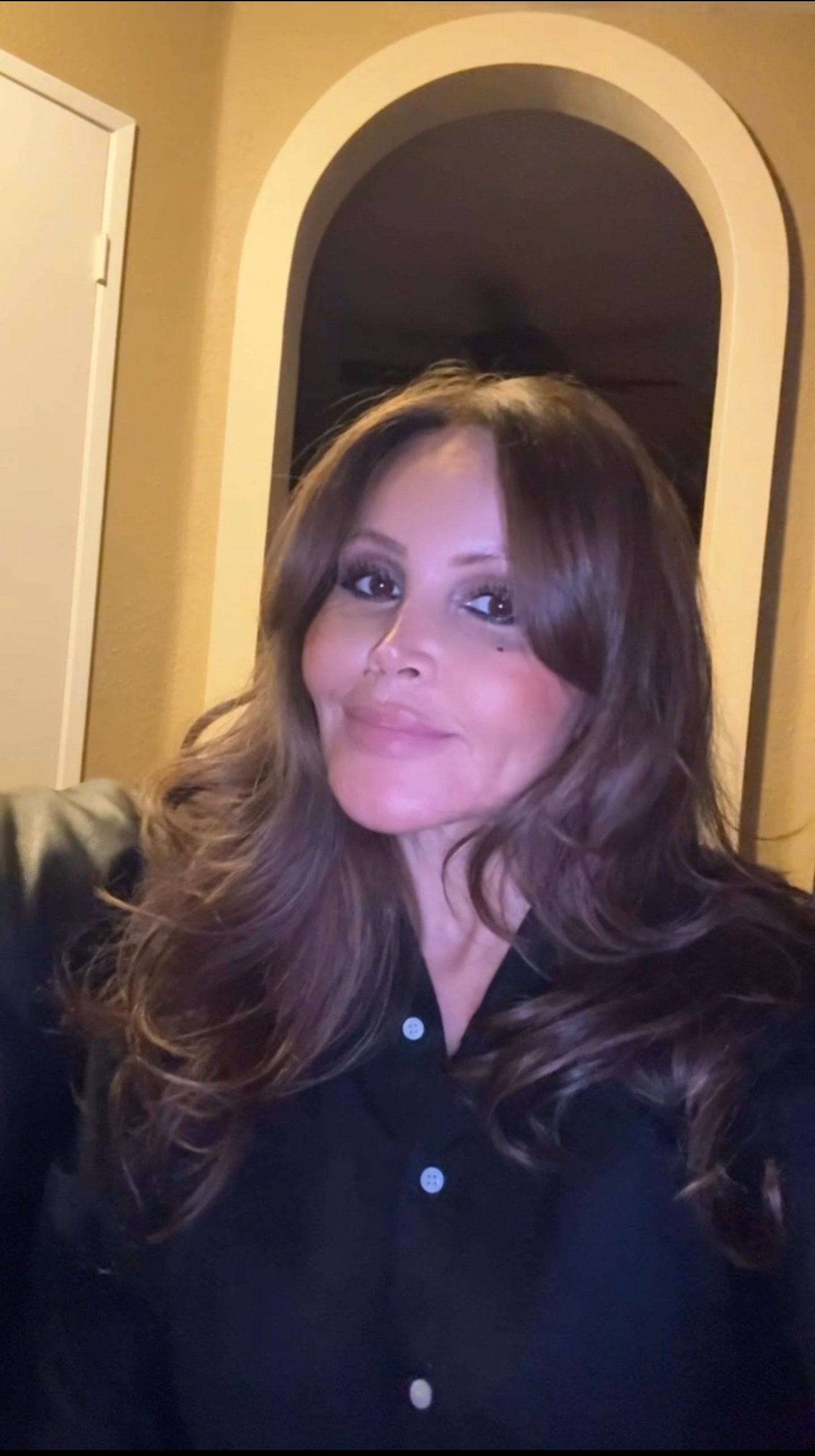 Adela Ashraf | Injectables by Adela in Tustin, CA, 92780