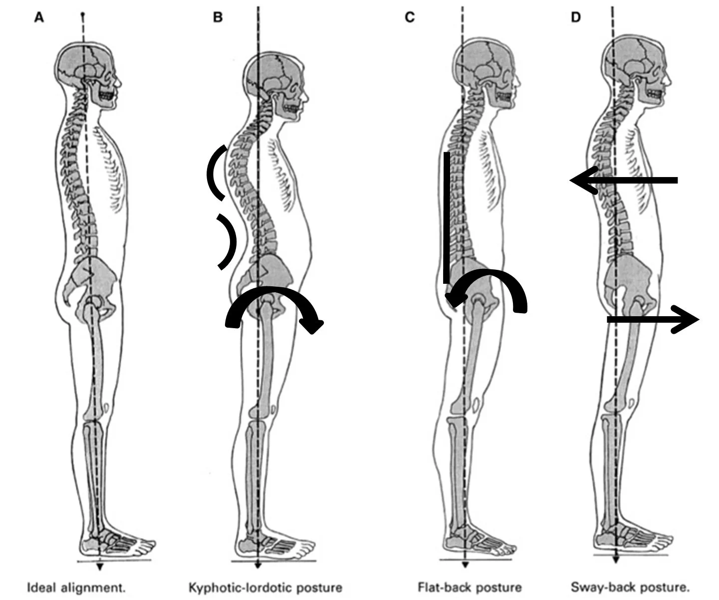 The Truth about “Bad” Posture