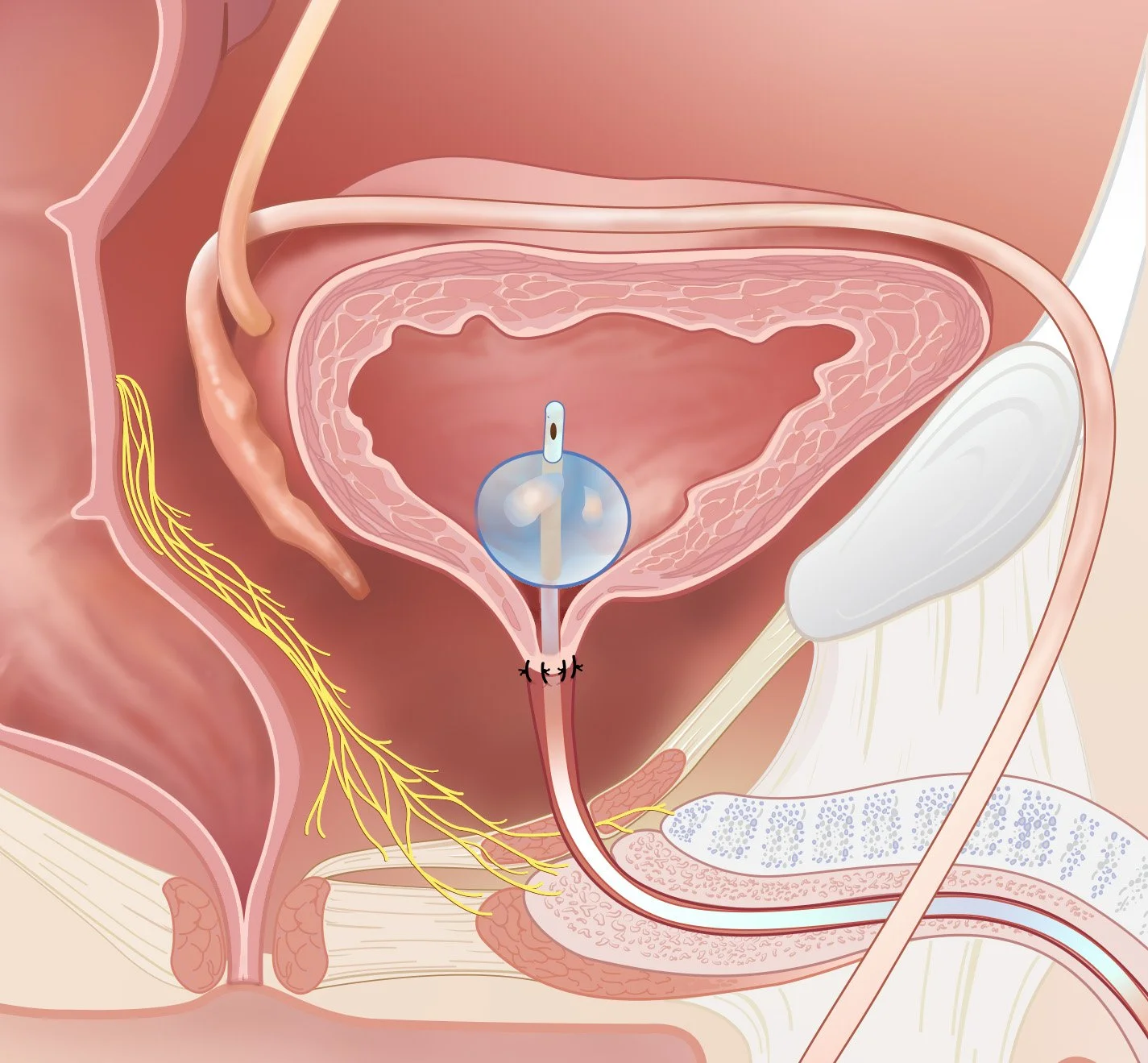 Foley-Recovered 01-31-2022.jpg