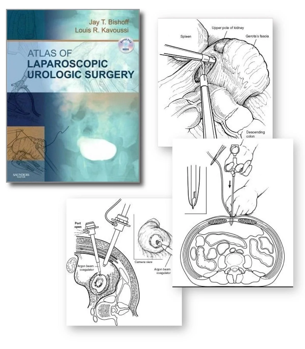 Bishoff Book Two.jpeg