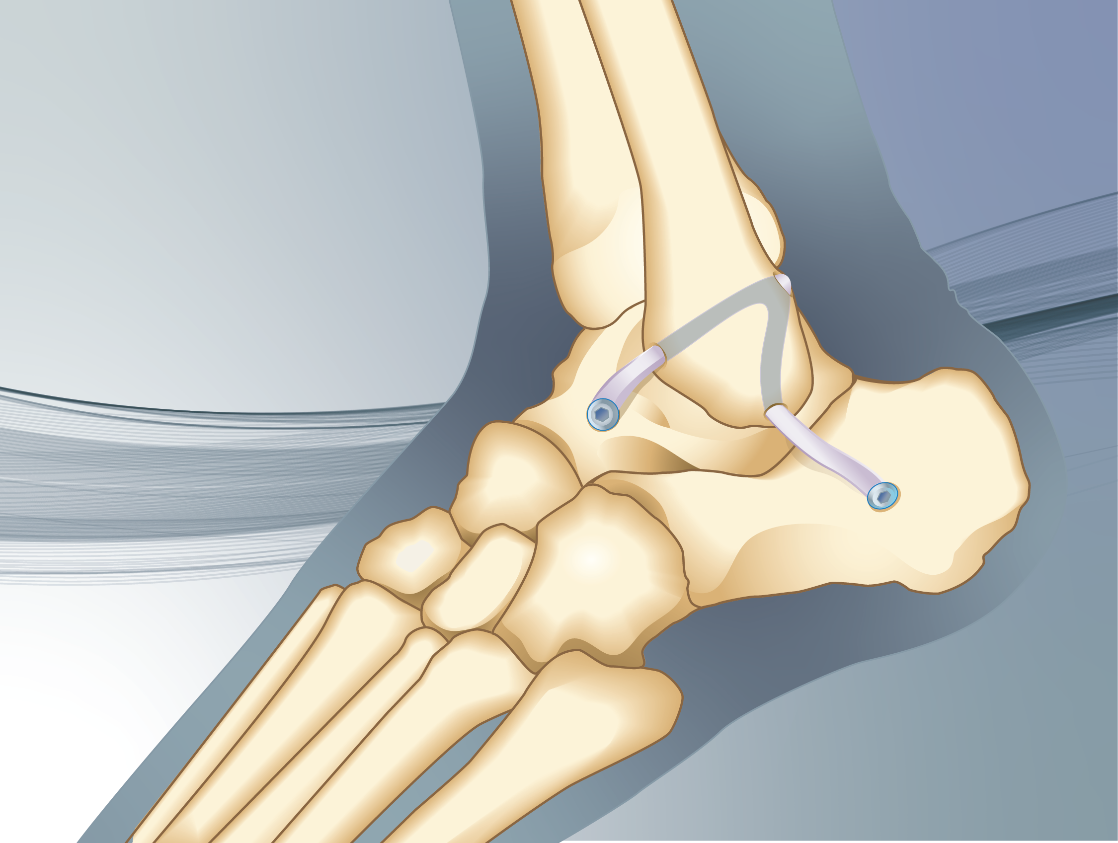 3 Images on SquareSpace.png