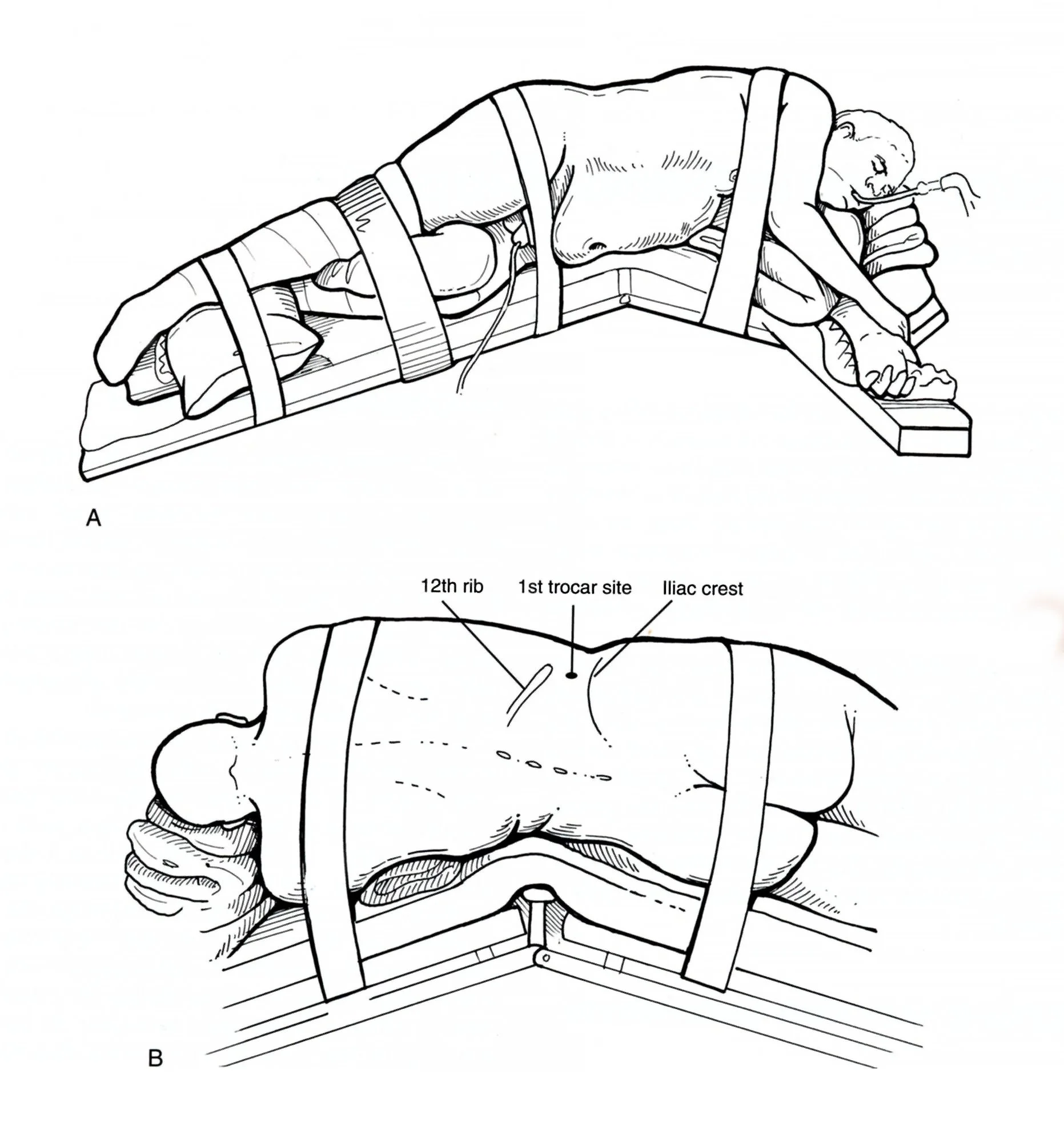 Bishoff side view.jpg