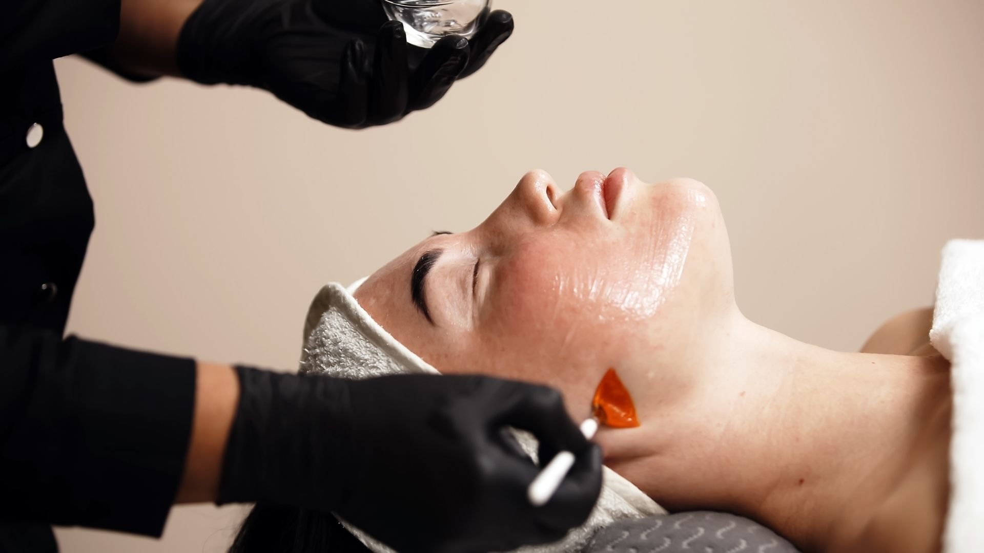 New female client receives a chemical peel treatment at Preparations Skin Spa in Richardson, TX