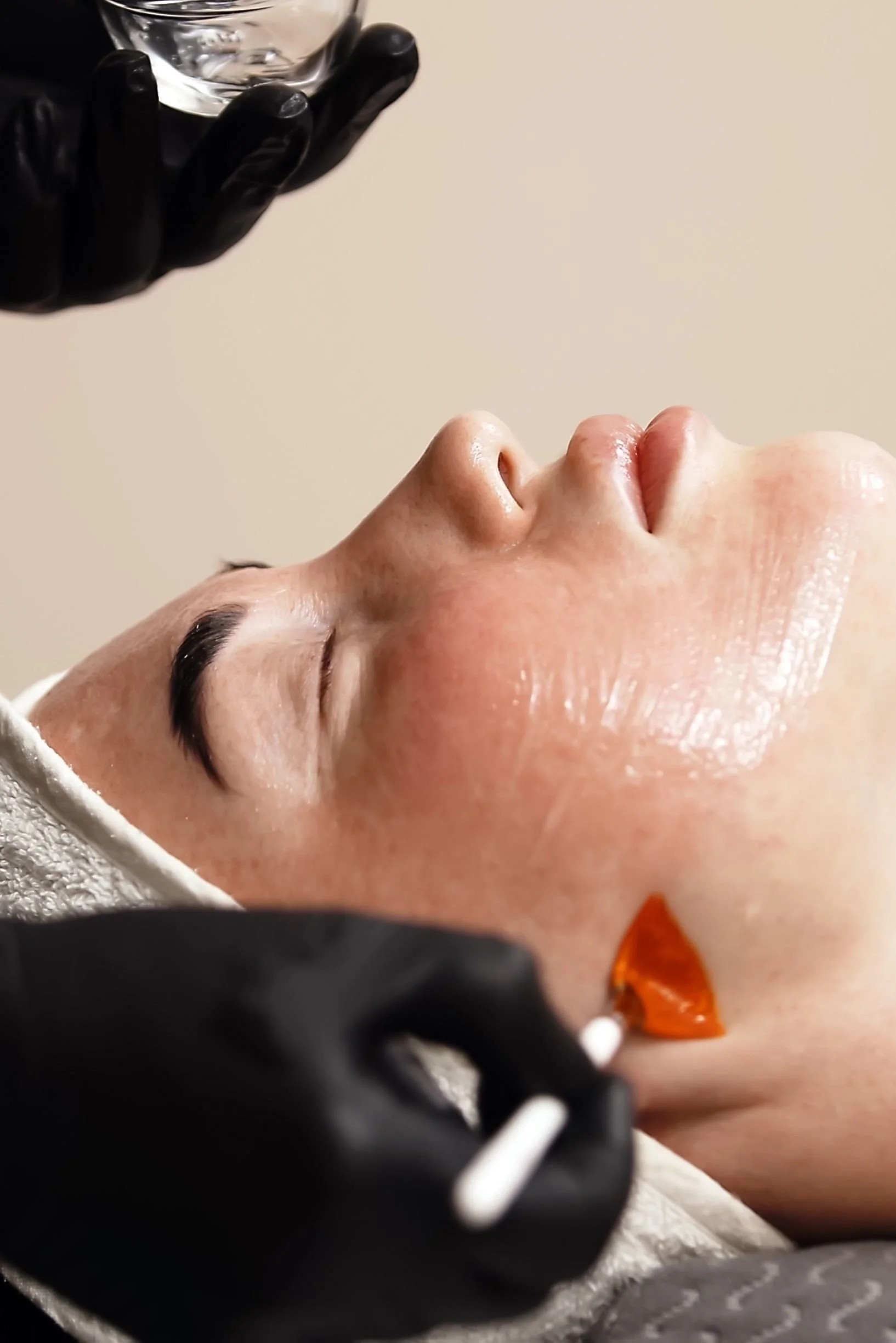 Female client with a chemical peel at Preparations Skin Spa in Richardson in progress