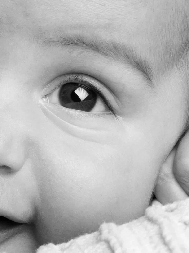 Close-up of a child's eye, part of their face, and a hand resting on their cheek in black and white.