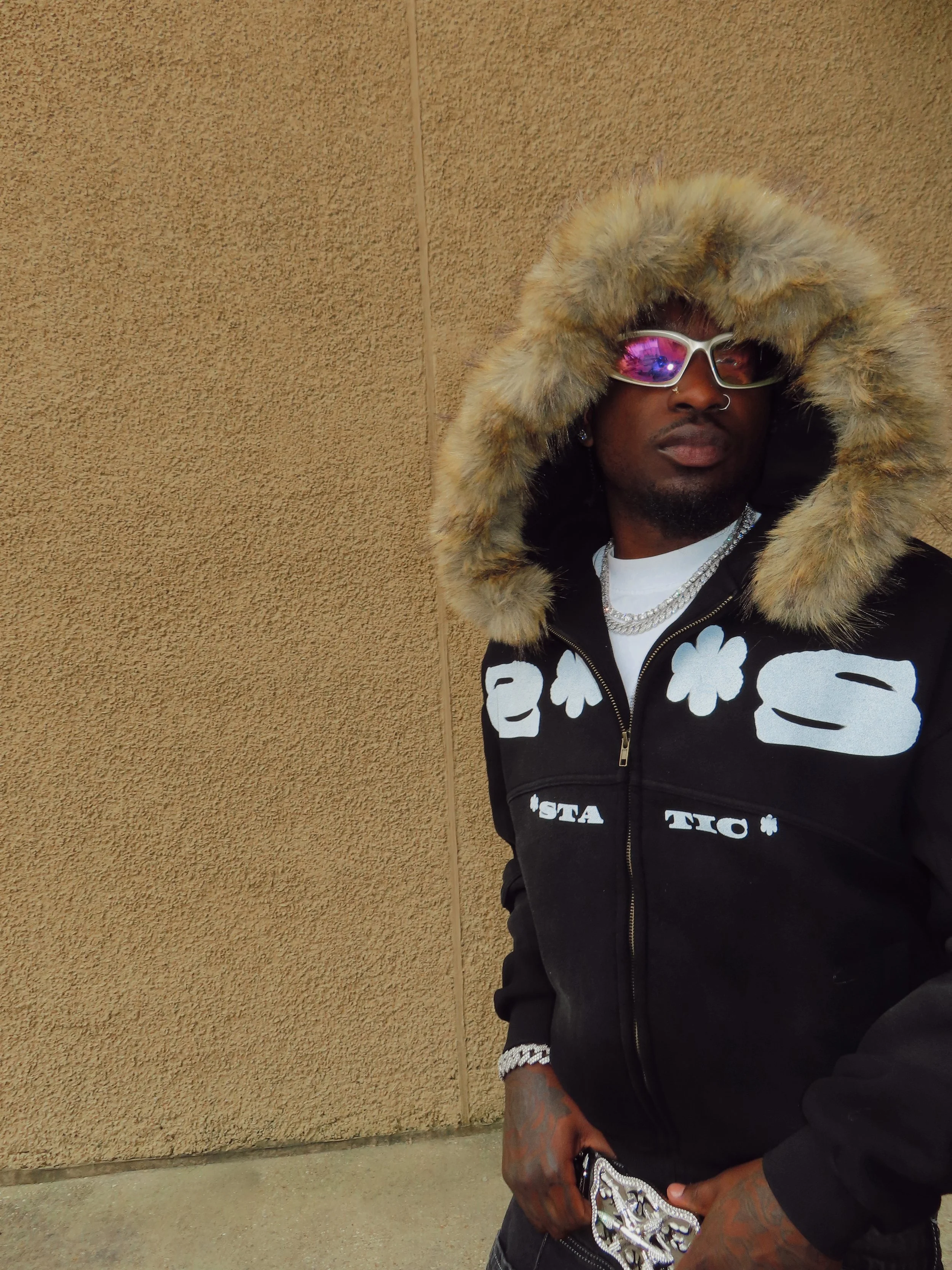 * STATIC * Sun Fade Boxy Detachable Fur Hoodie