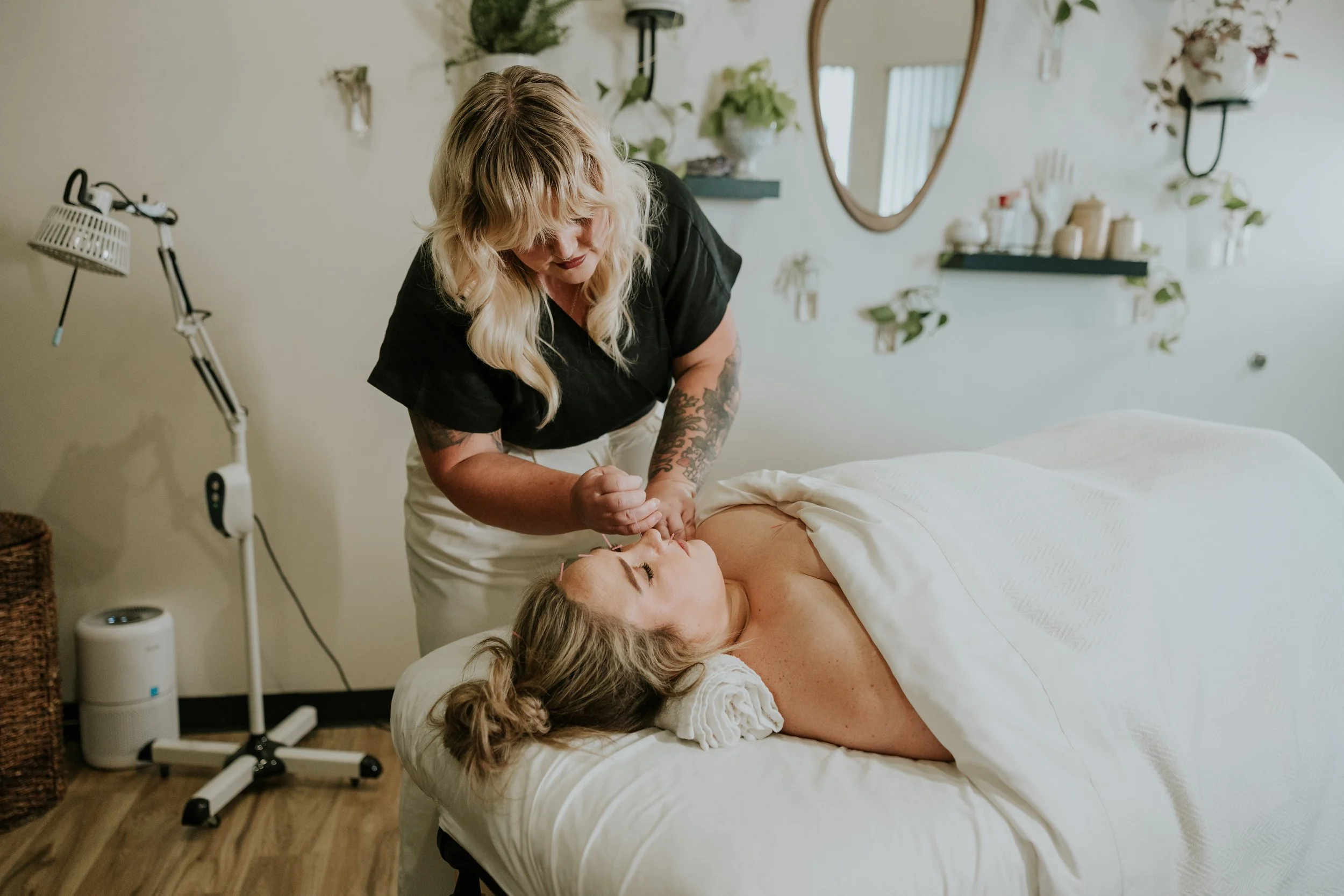 What Acupuncture Can Support Beyond Pain Relief