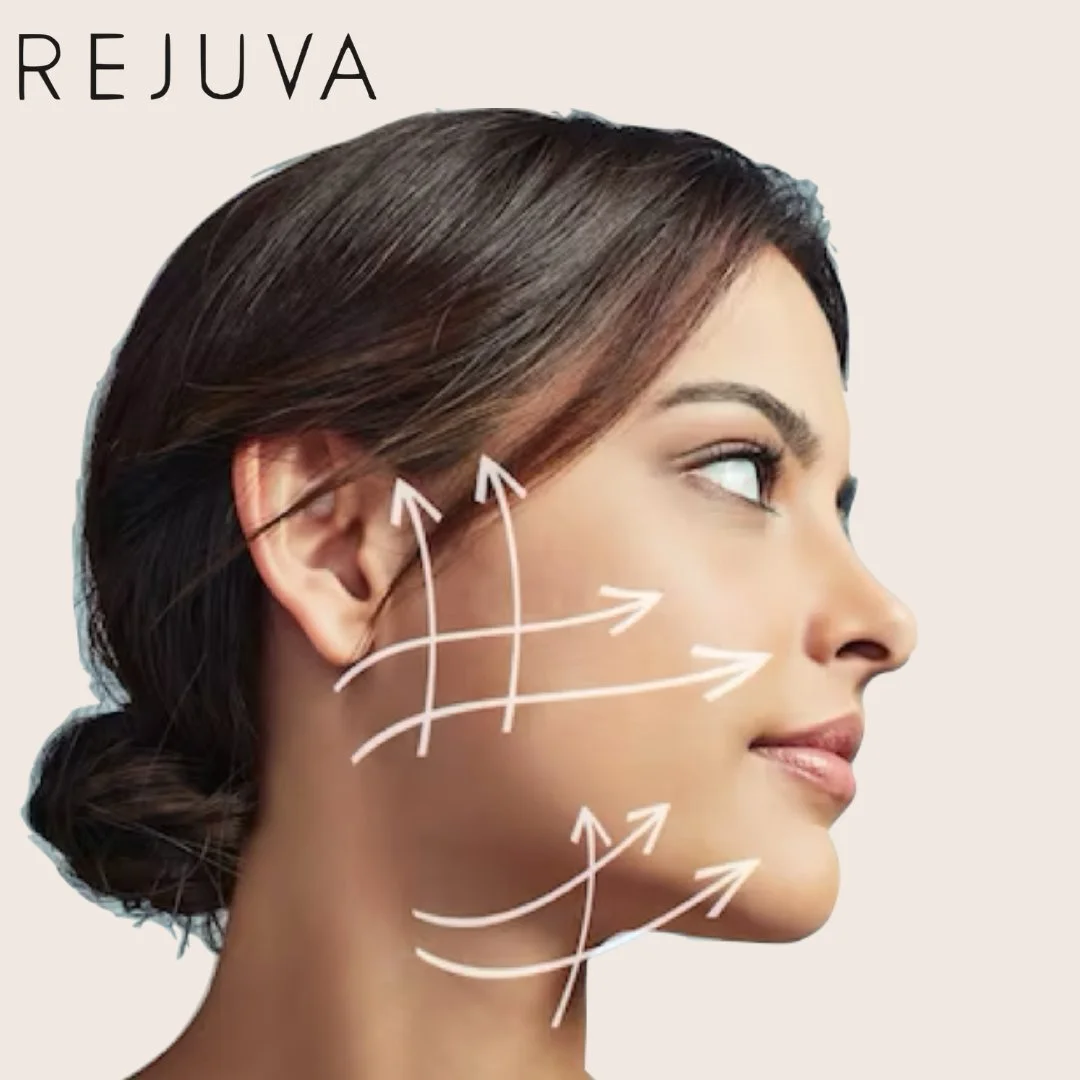 😍We&rsquo;re SO excited to finally offer the next-generation thread- lifting technology that everyone&rsquo;s talking about. The Minimally Invasive Nonsurgical Thread Lift (also known as MINT Lift) is here!

✨A MINT Lift is an easy way to smooth wri