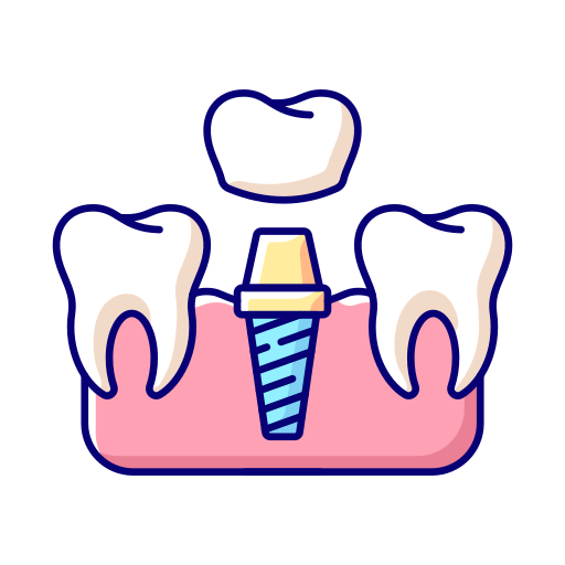 Illustration of a dental implant with a crown and two natural teeth on either side.