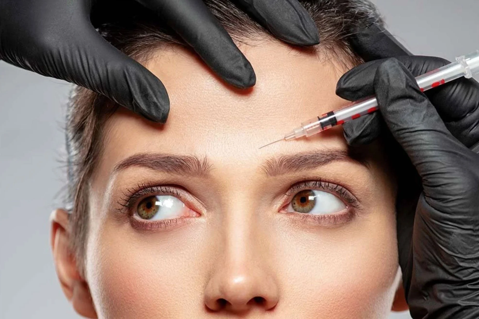 Woman receiving anti wrinkle injection at Staffordshire clinic