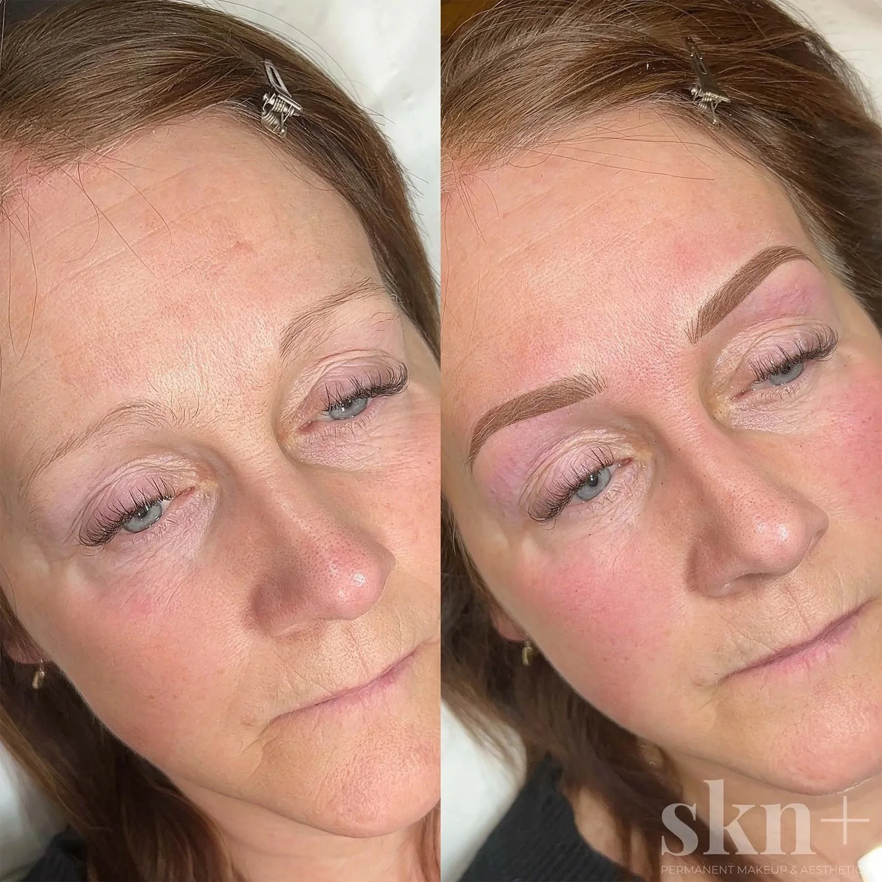 combo-brows-1-skn-plus-in-stone-near-stafford-and-stoke-on-trent-staffordshire.jpg