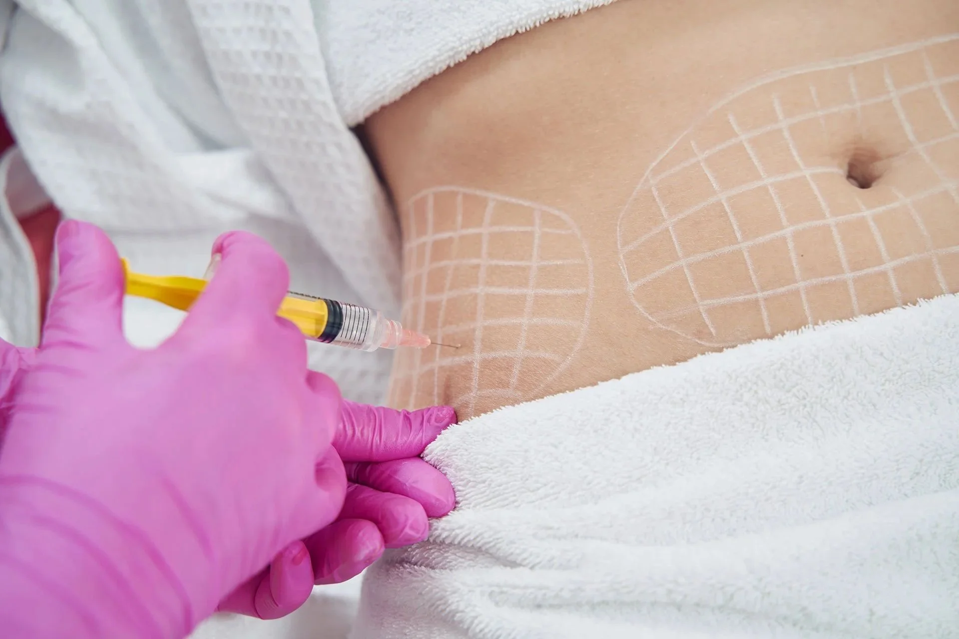 Fat Dissolving Injections: What are they, the benefits, how to get the best results &amp; more.