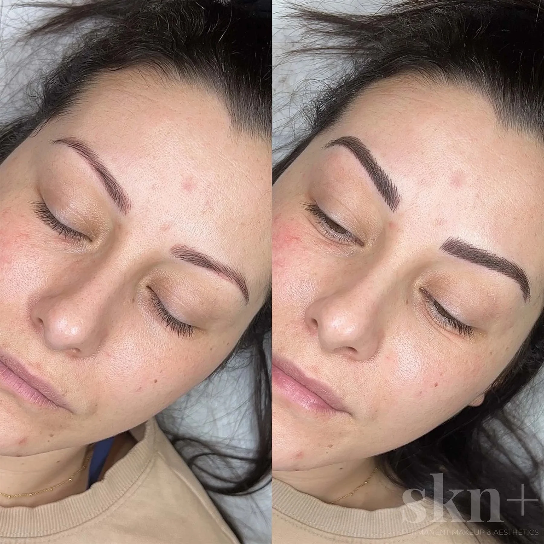 combo-brows-2-skn-plus-in-stone-near-stafford-and-stoke-on-trent-staffordshire.jpg