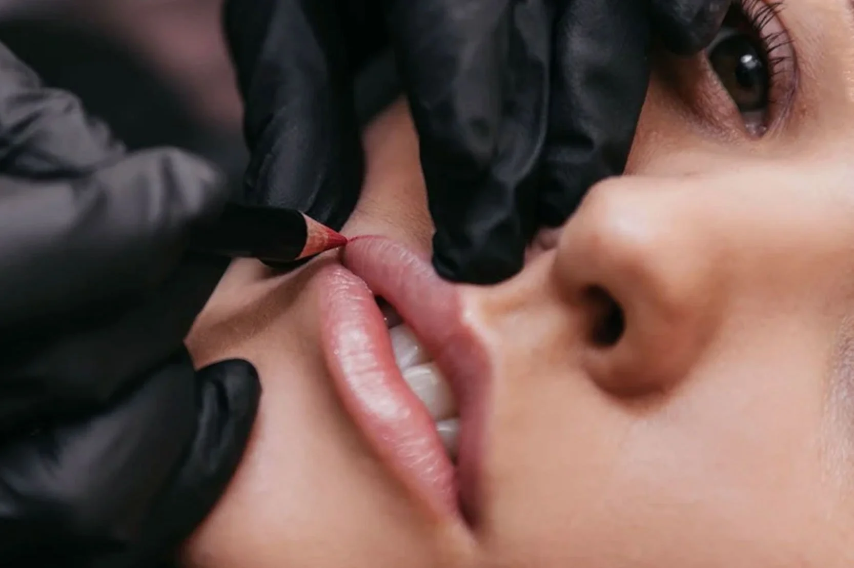 Woman in Staffordshire receiving permanent lip treatments