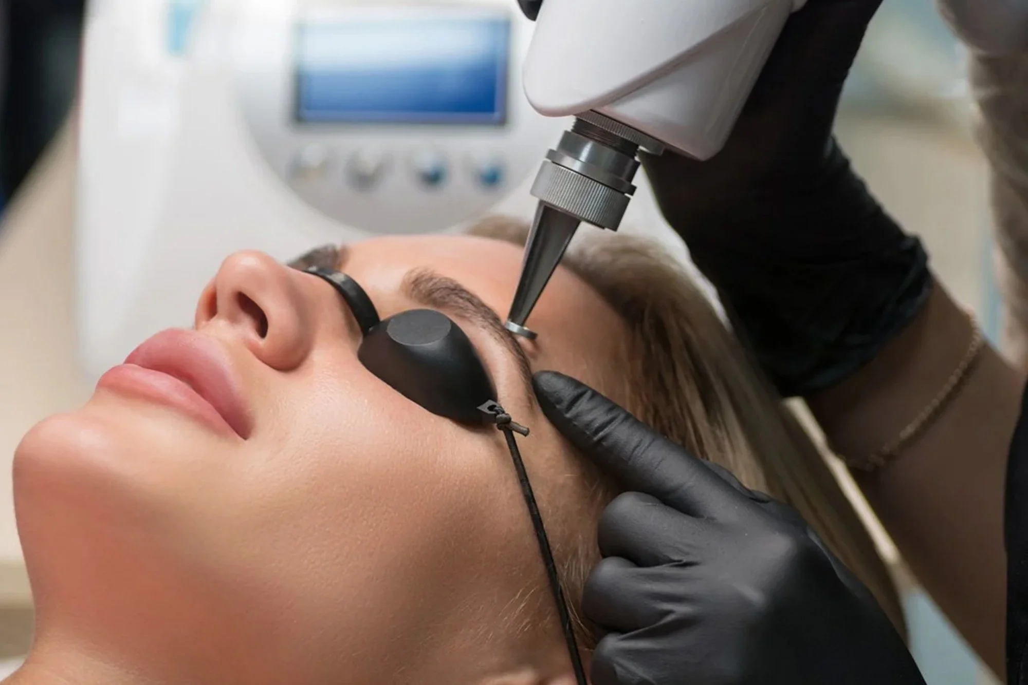 Woman having laser tattoo treatment in Staffordshire