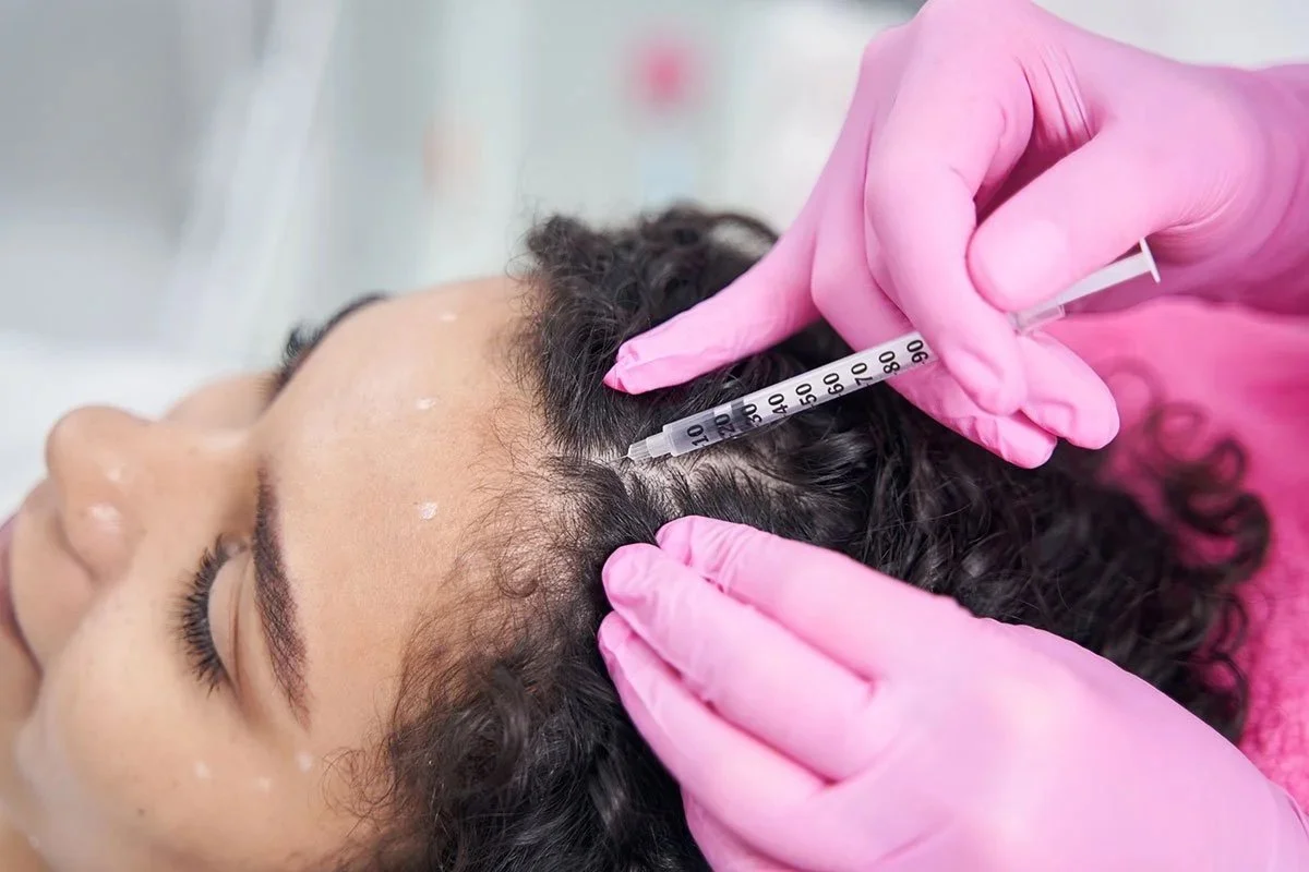 Woman receiving hair restoration treatment Staffordshire