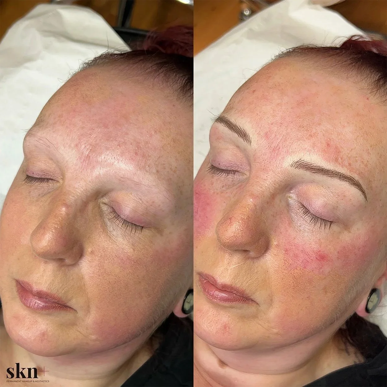 permanent-makeup-microblading-combo-ombre-brows5-skn-plus-in-stone-by-stafford-and-stoke-on-trent-staffordshire.jpg