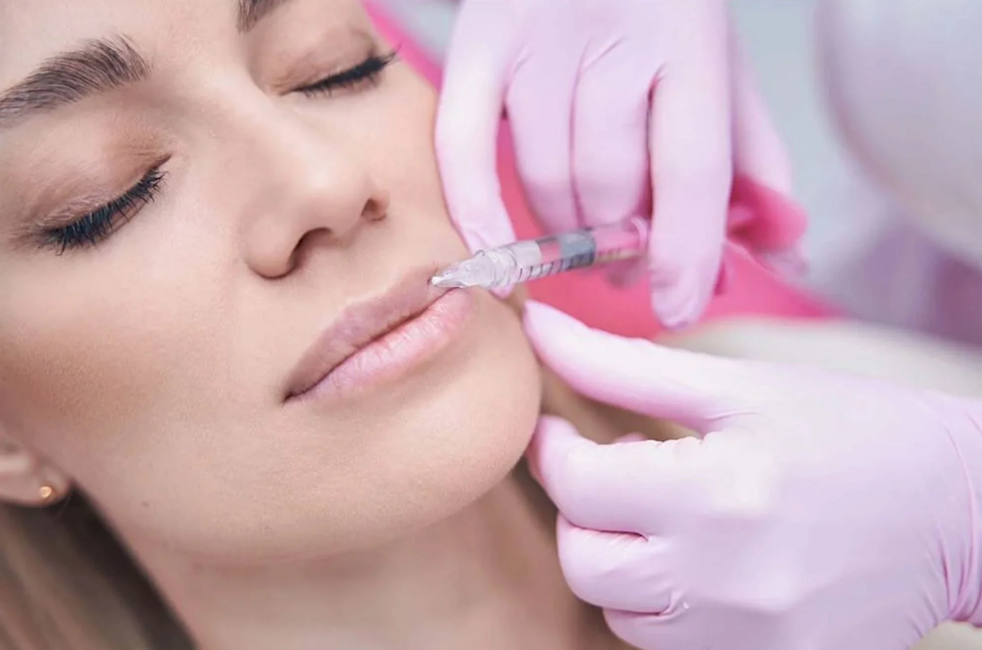 Woman receiving lip filler injection