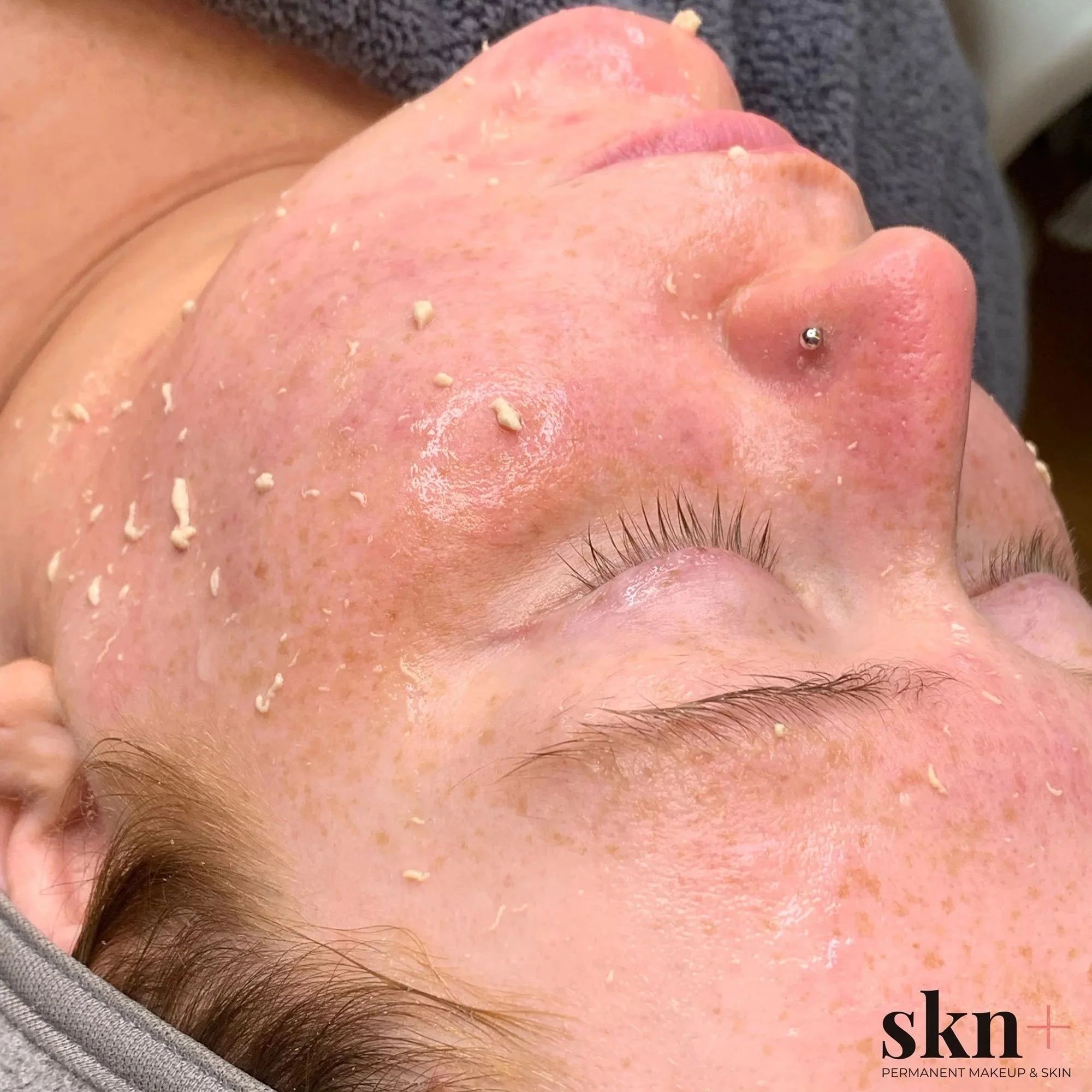 skn-plus-facial-treatments-6.jpg