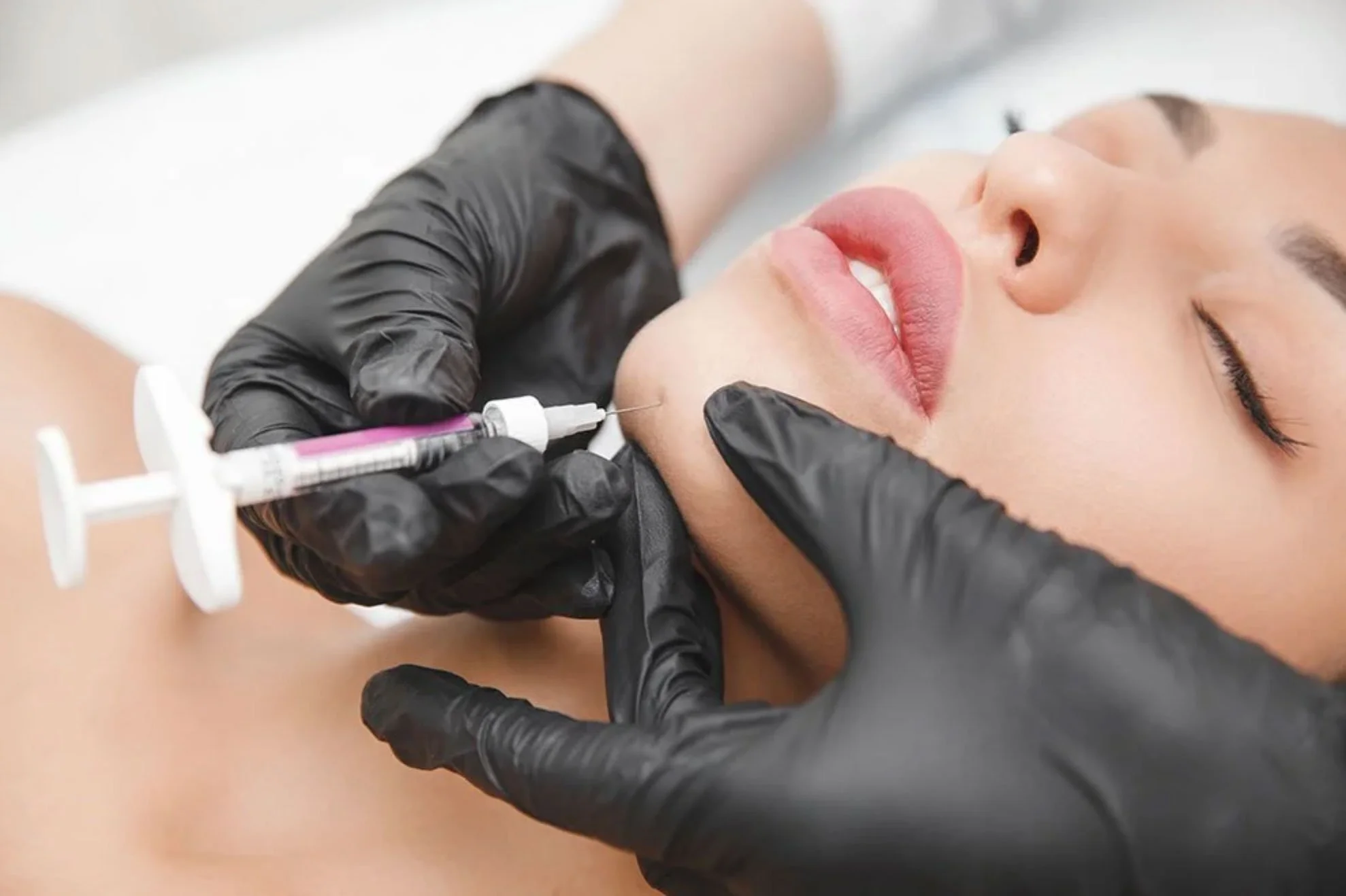 Woman receiving dermal filler injections at Staffordshire clinic