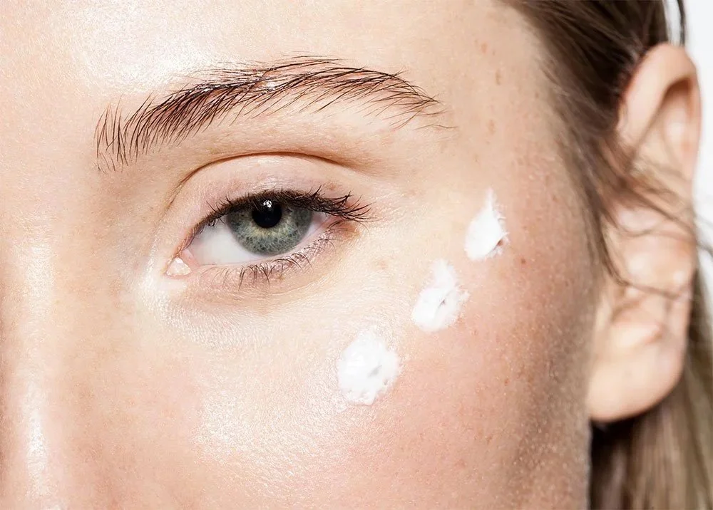 Blackheads: What are they and how do we get rid of them?
