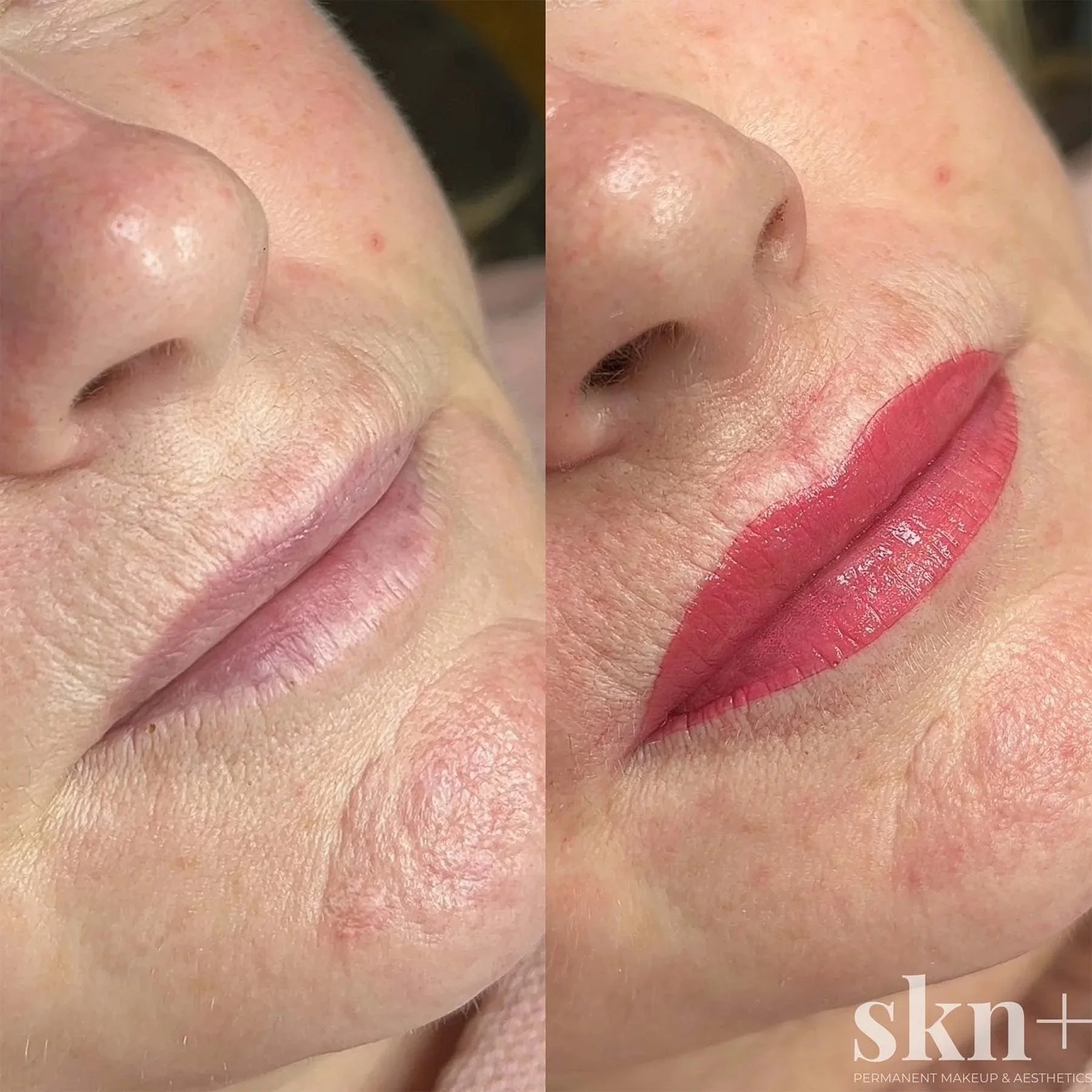 lip-blush-3-skn-plus-in-stone-near-stafford-and-stoke-on-trent-staffordshire.jpg