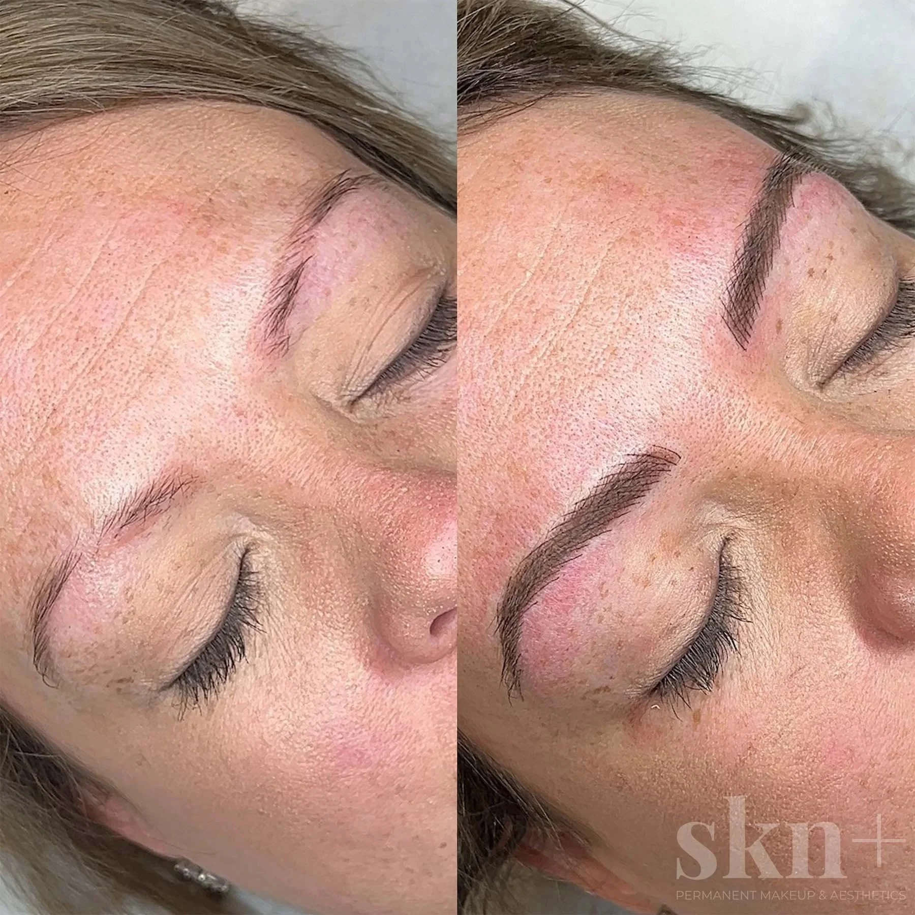 combo-brows-3-skn-plus-in-stone-near-stafford-and-stoke-on-trent-staffordshire.jpg