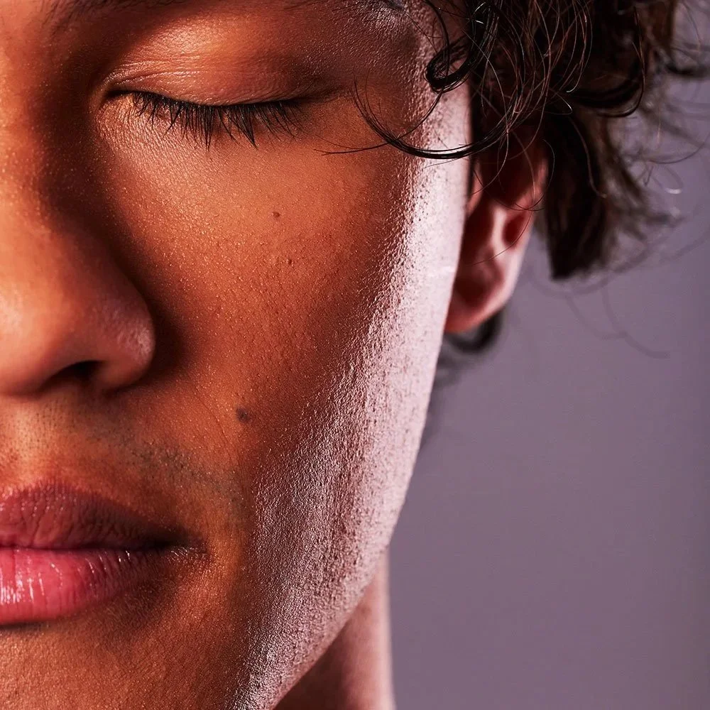 Close up of mans face after dermal filler treatment in Staffordshire
