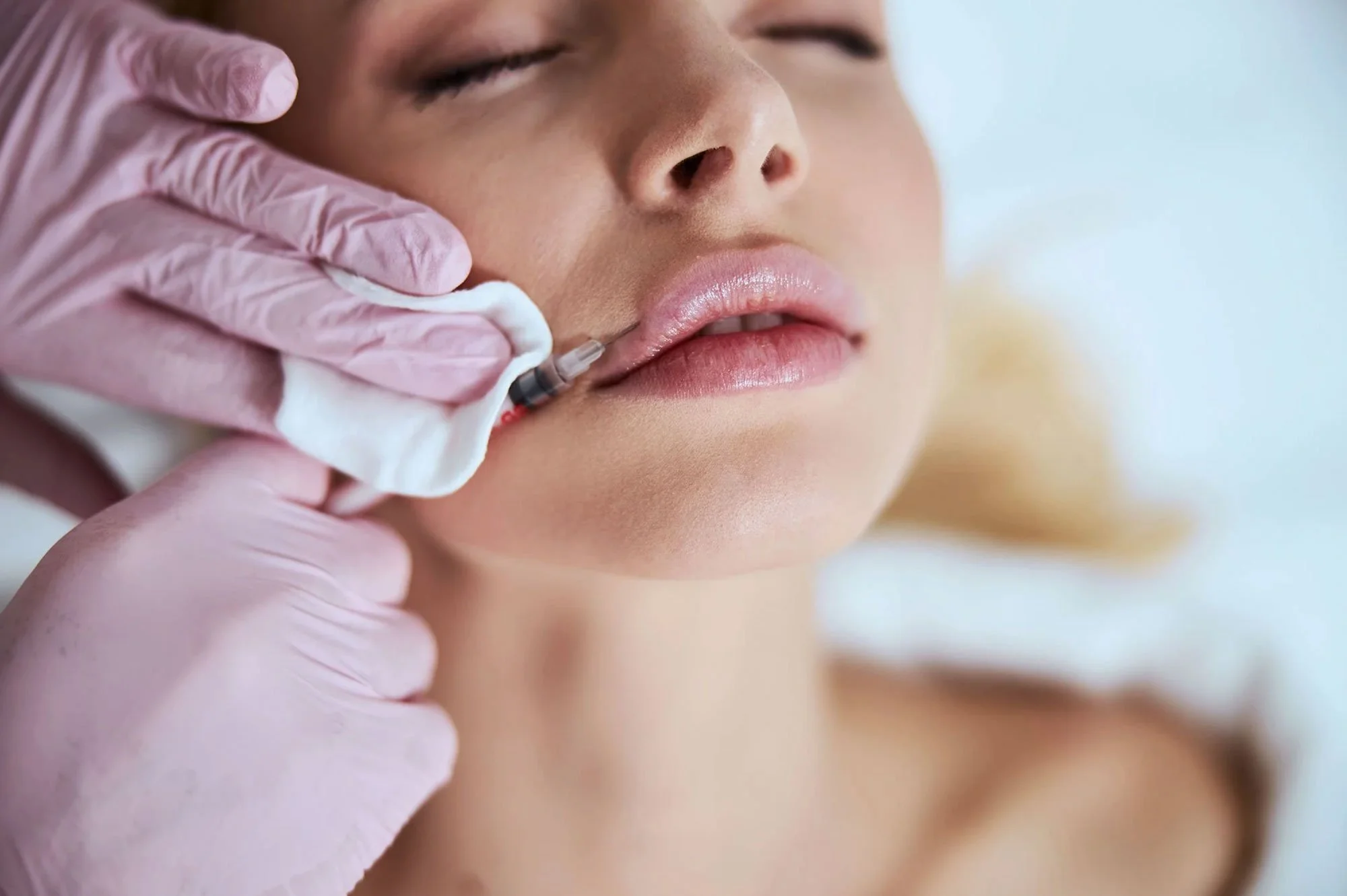 Woman in Staffordshire receiving lip filler injection