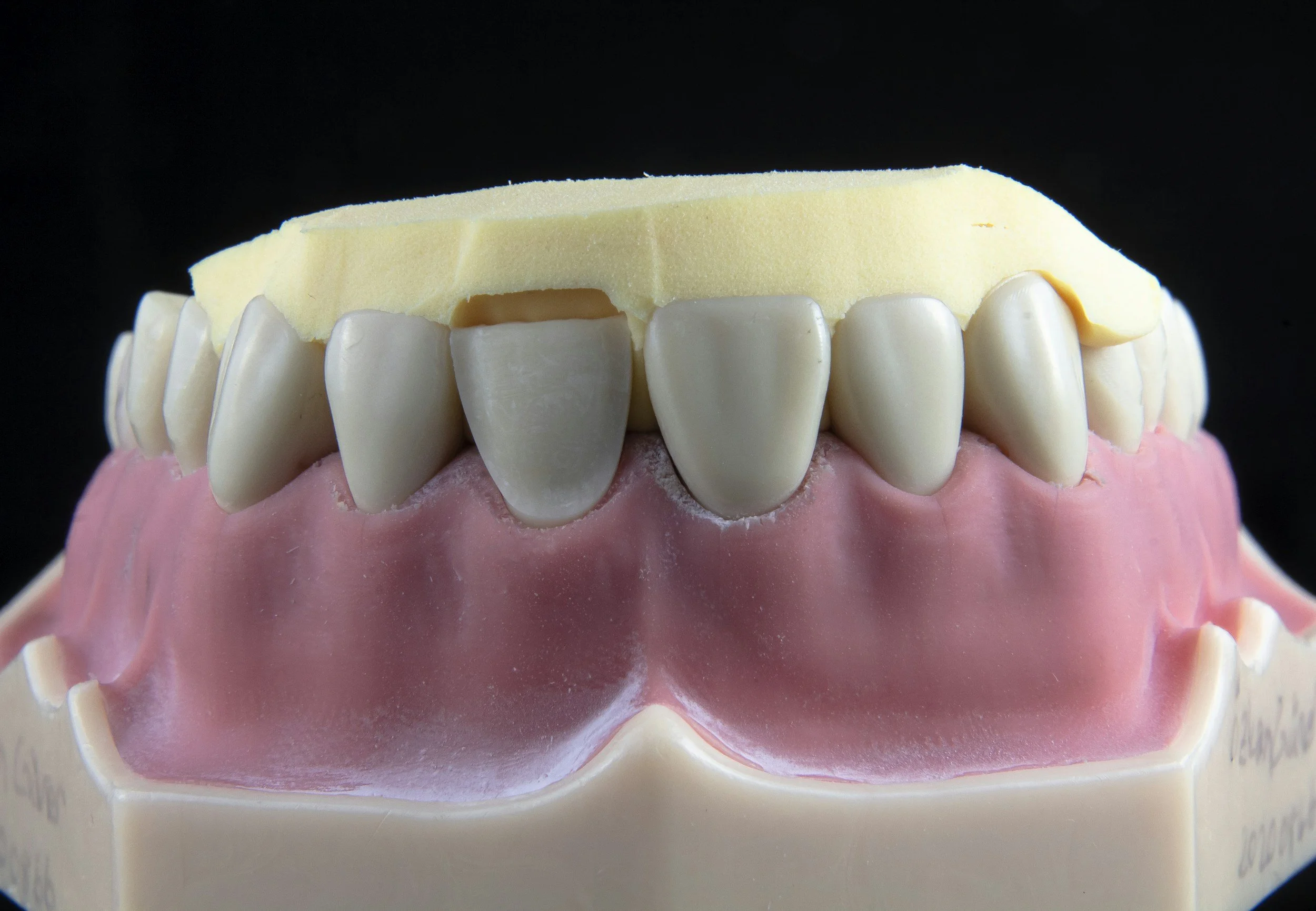 Dental model showing upper teeth with a yellow wax mock-up on top, set in pink gum-colored base.