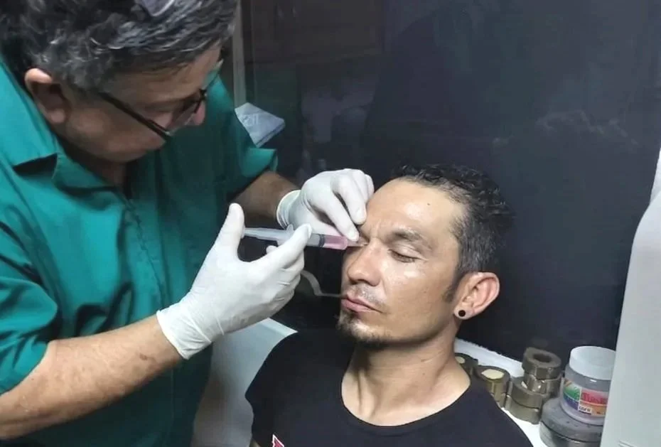 Un hombre recibiendo una inyección en el rostro por parte de un profesional con guantes blancos, en un entorno clínico.