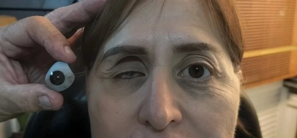 Una persona con un ojo vendado y sosteniendo una vista que imita un ojo en la mano, con decoración de oreja y ojos en la mano.