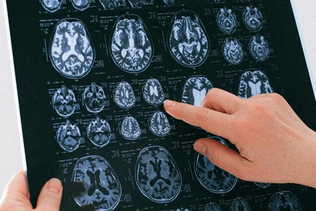 Huntington’s Disease Awareness