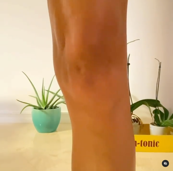 Your Knee Pain Could be a Kneecap Tracking Issue