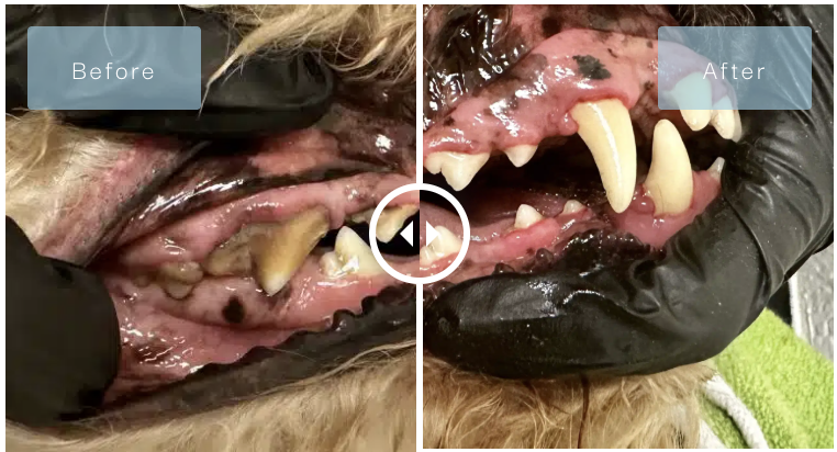 before after dental.png